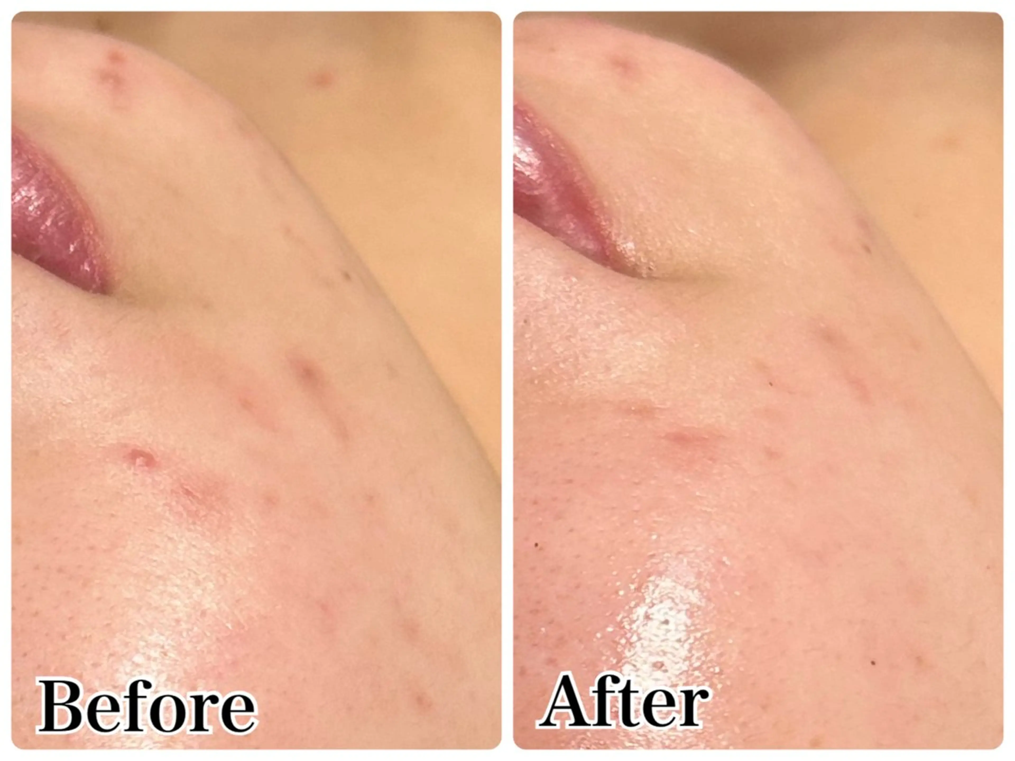 エステ Gemini 　MIKIのエステ・リラクイメージ