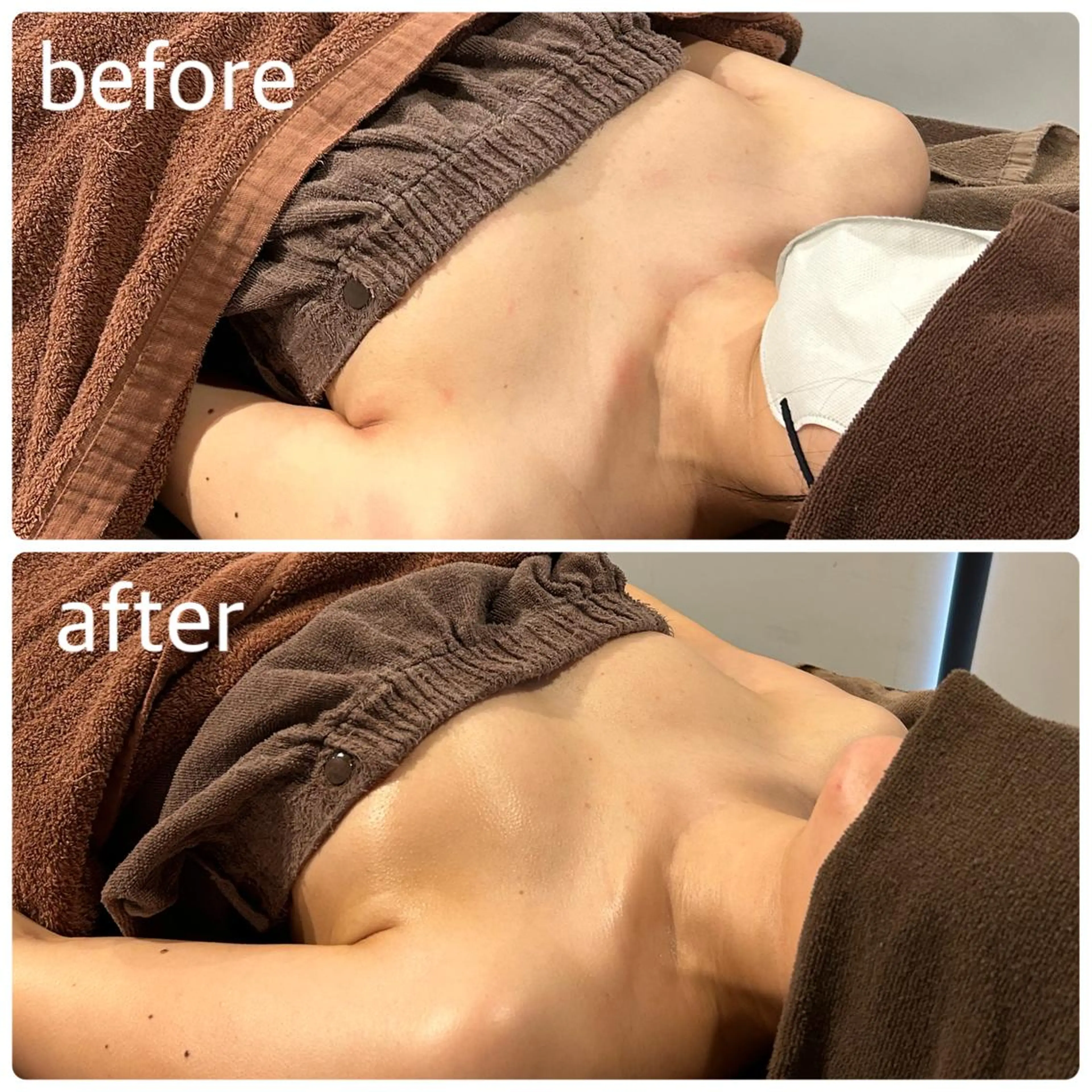 バストアップマッサージ＋美容液導入💕60分の写真