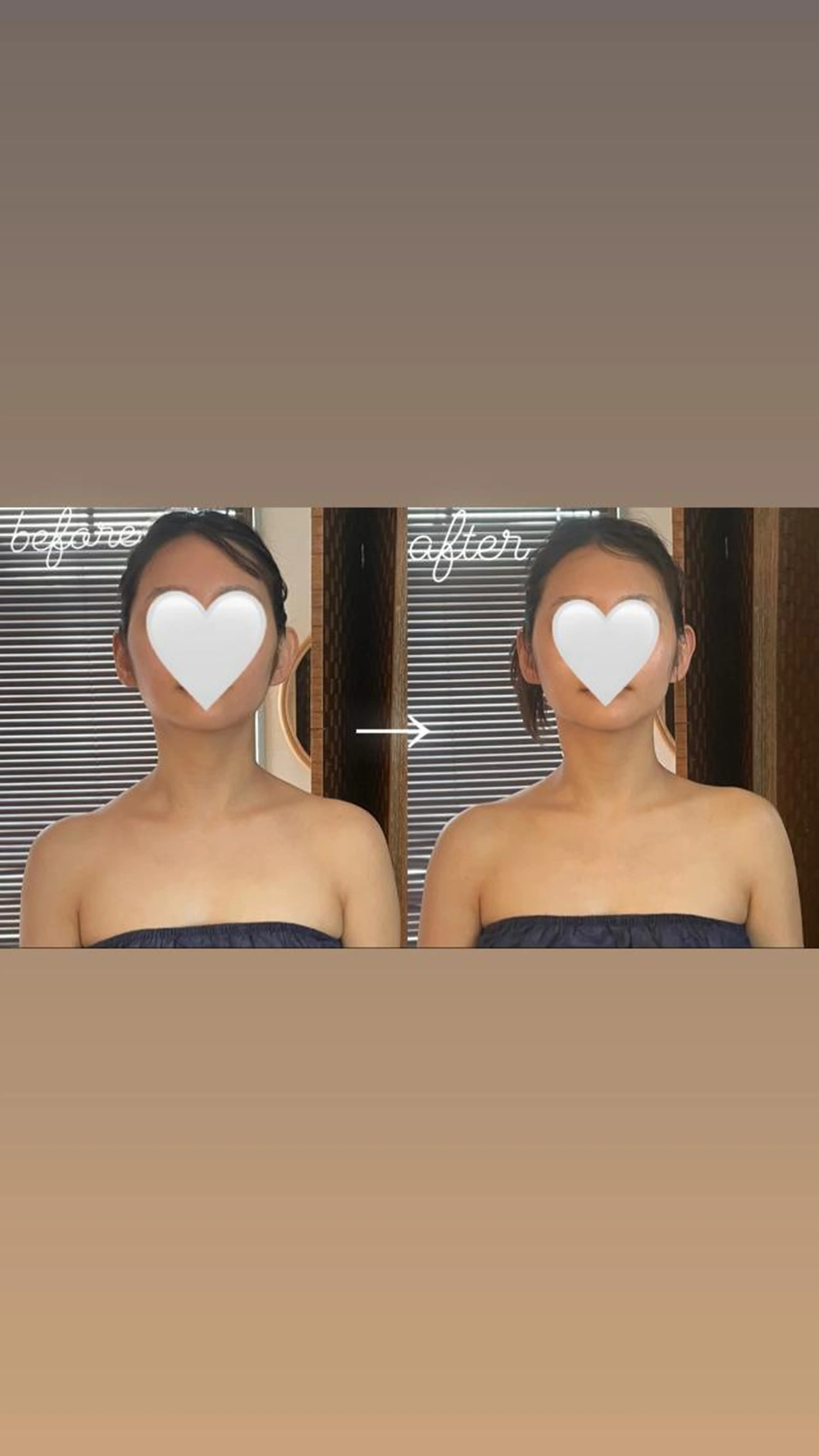 ハイパーナイフ小顔韓流モデルコース✨の写真