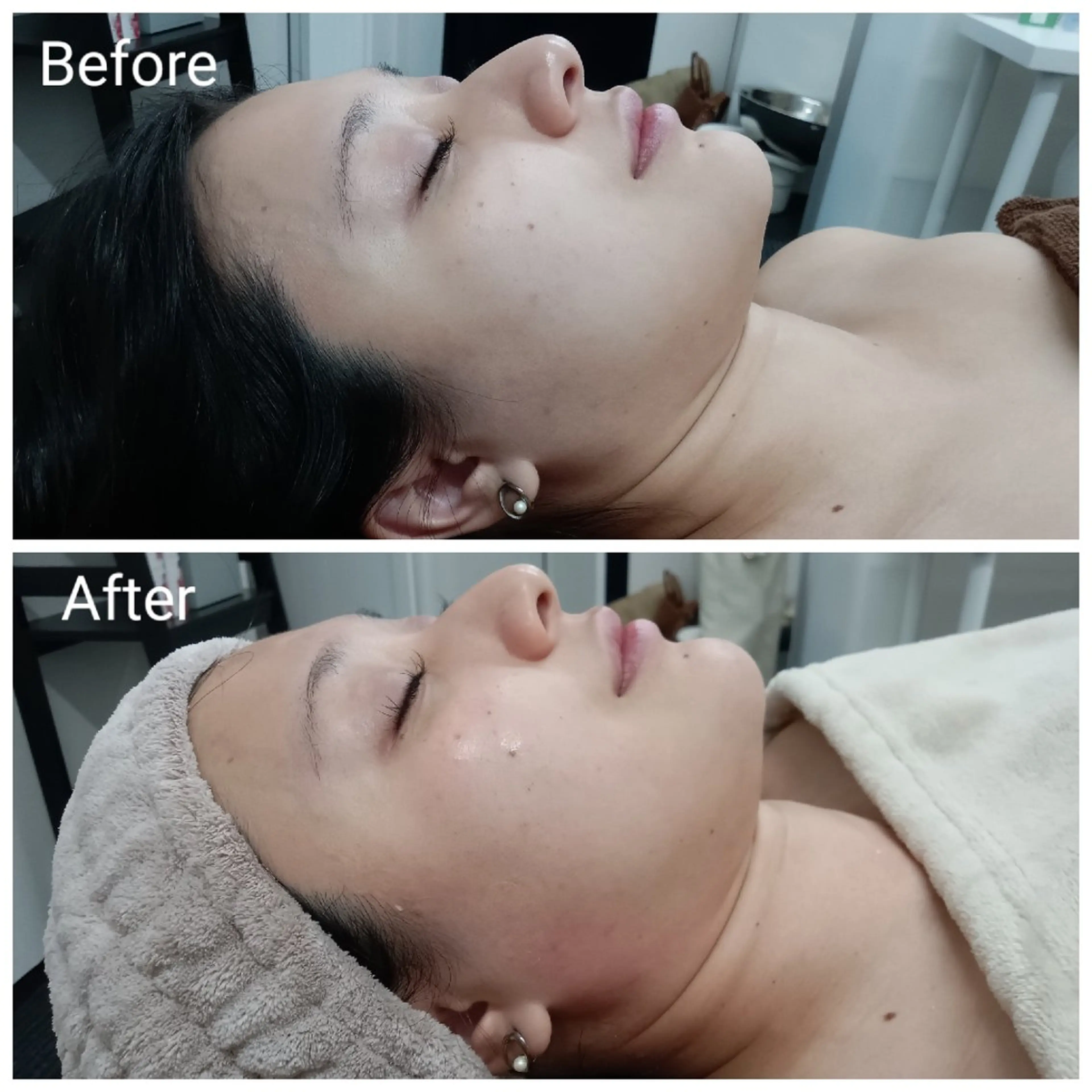 肌質改善Beauty salon Renのエステ・リラクイメージ