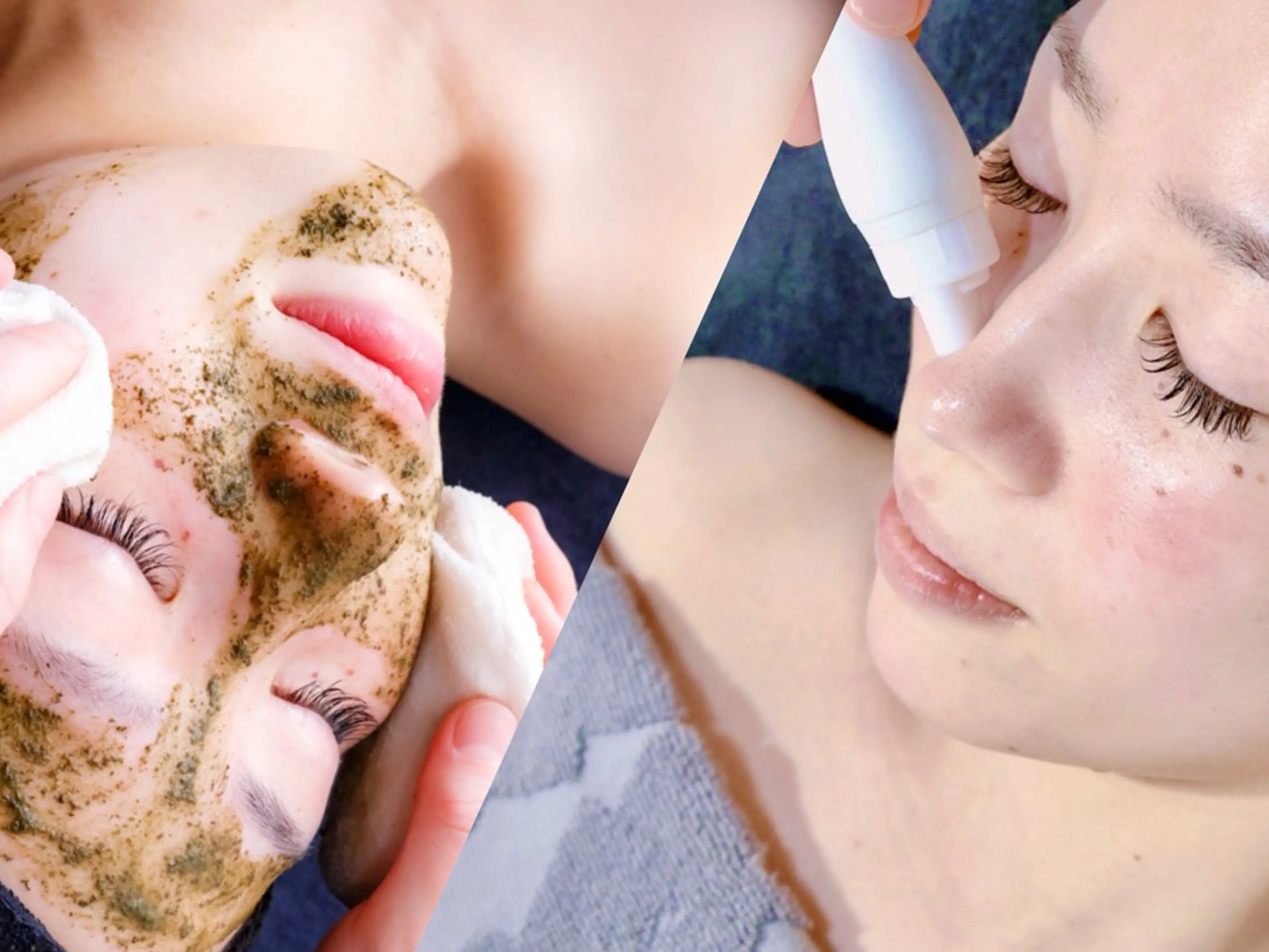 【人気No.1/徹底毛穴ケア】ハーブピーリング＆ハイドロ毛穴洗浄の写真