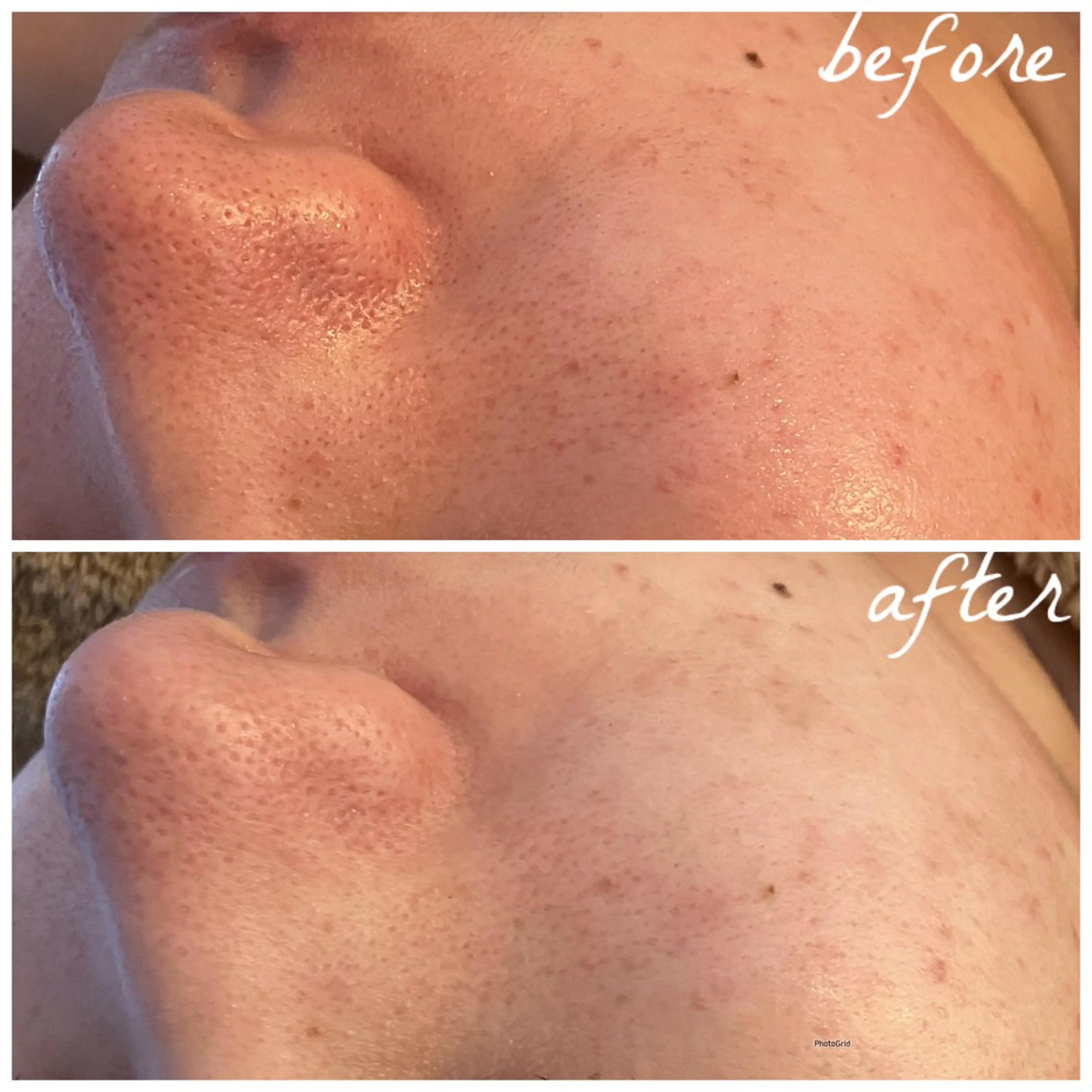 メンズ メナード岐阜茜部 杉浦のエステ・リラクイメージ