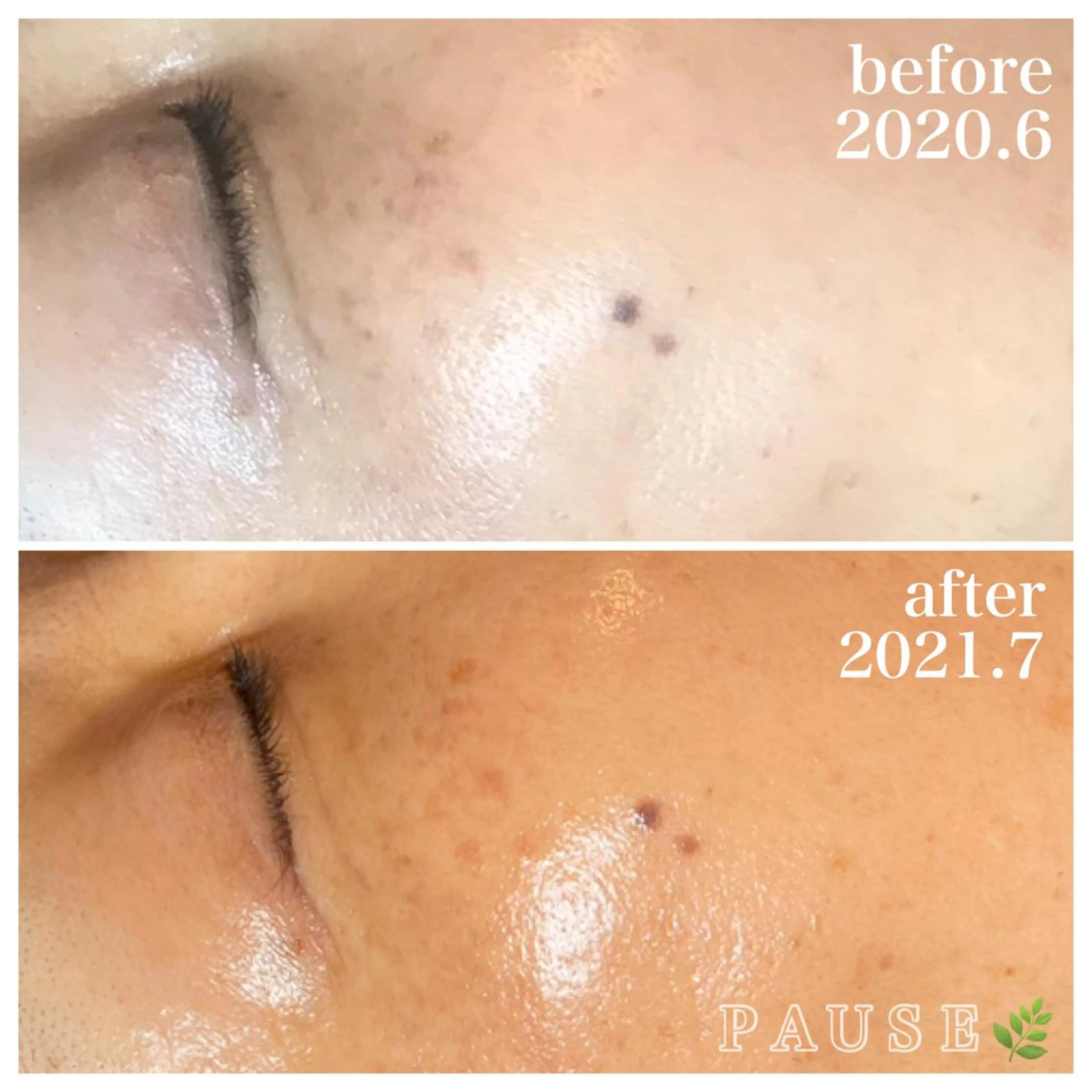 エステ 浜野 恵美のエステ・リラクイメージ