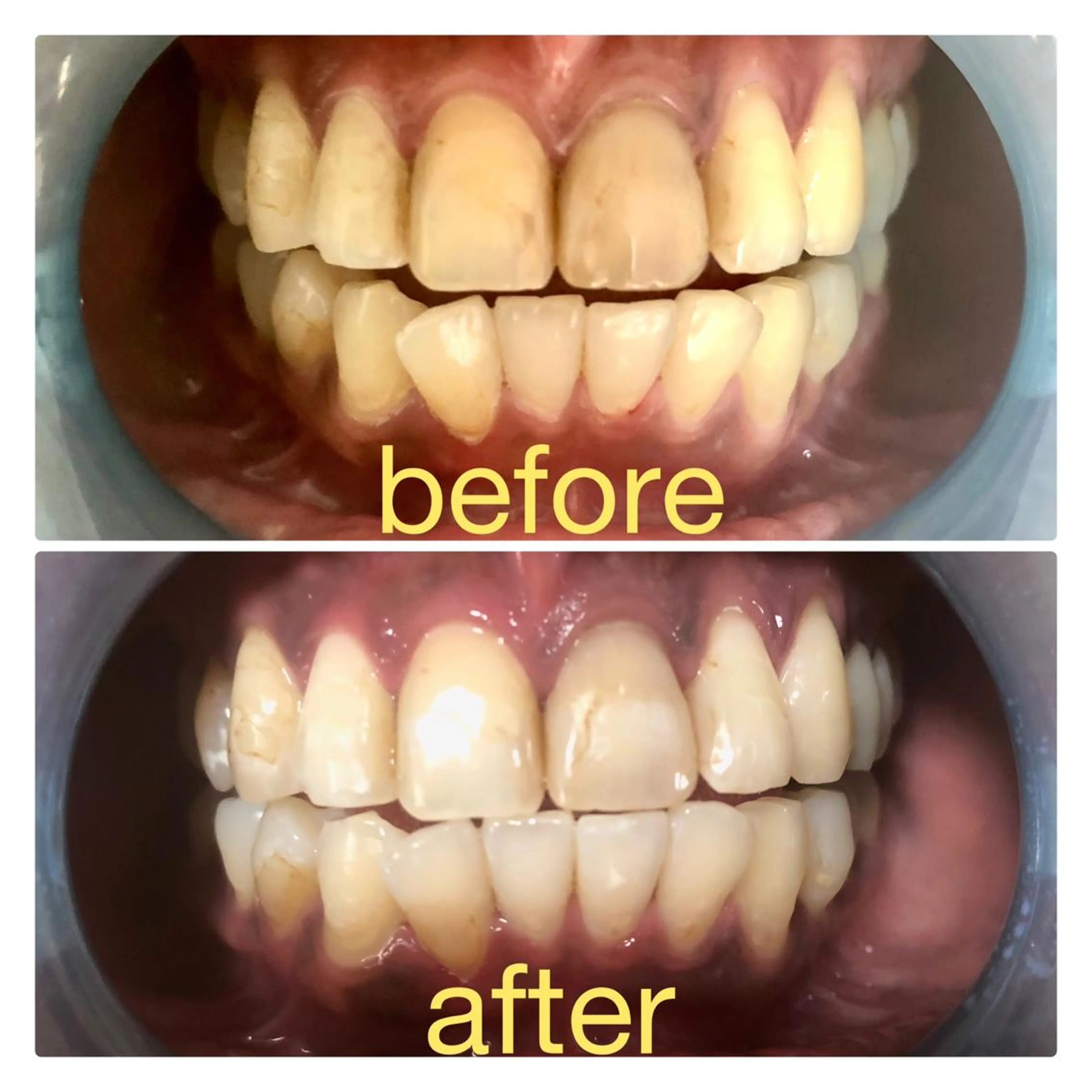 その他 two nailのネイルデザイン