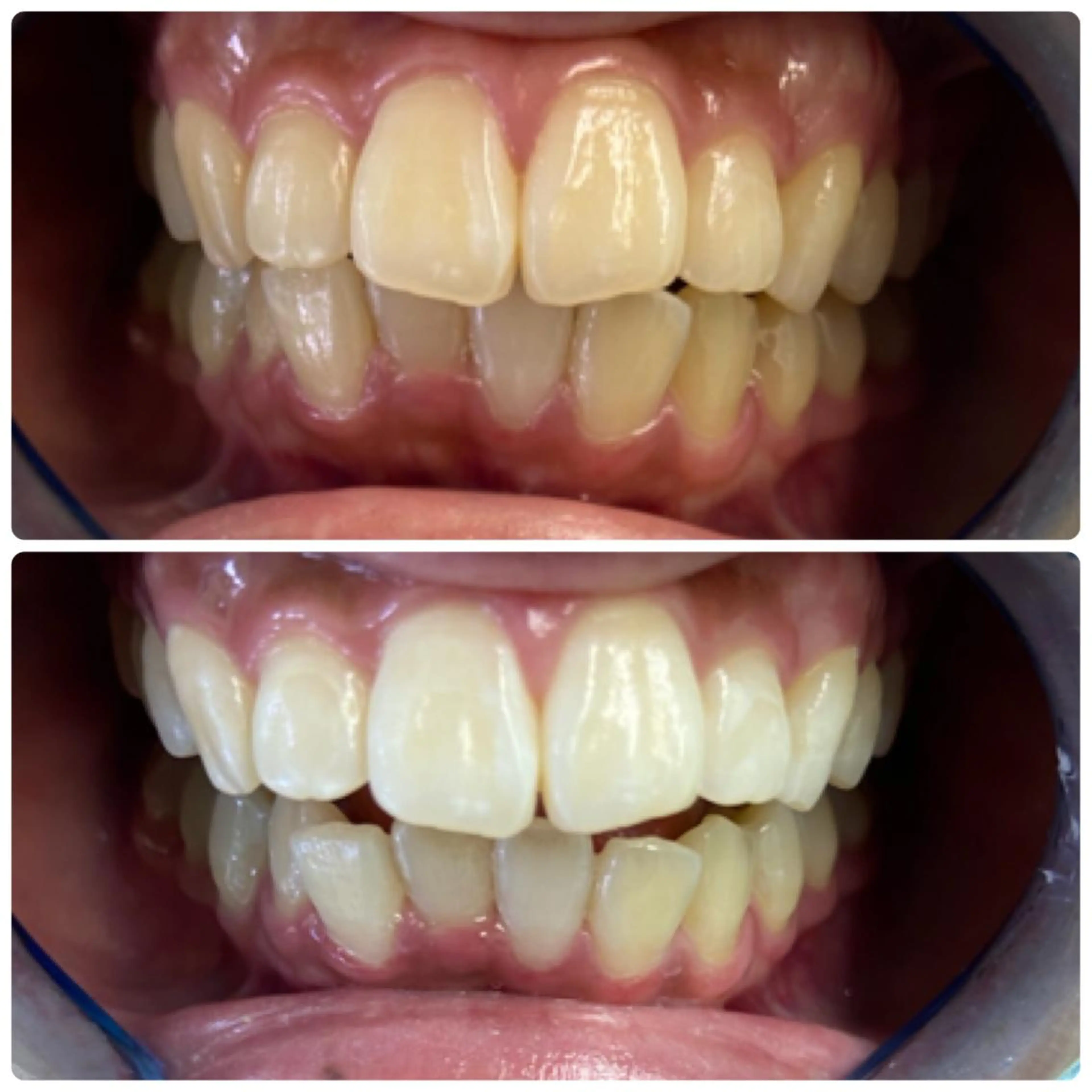 ホワイトニングルーム 横浜店のその他イメージ