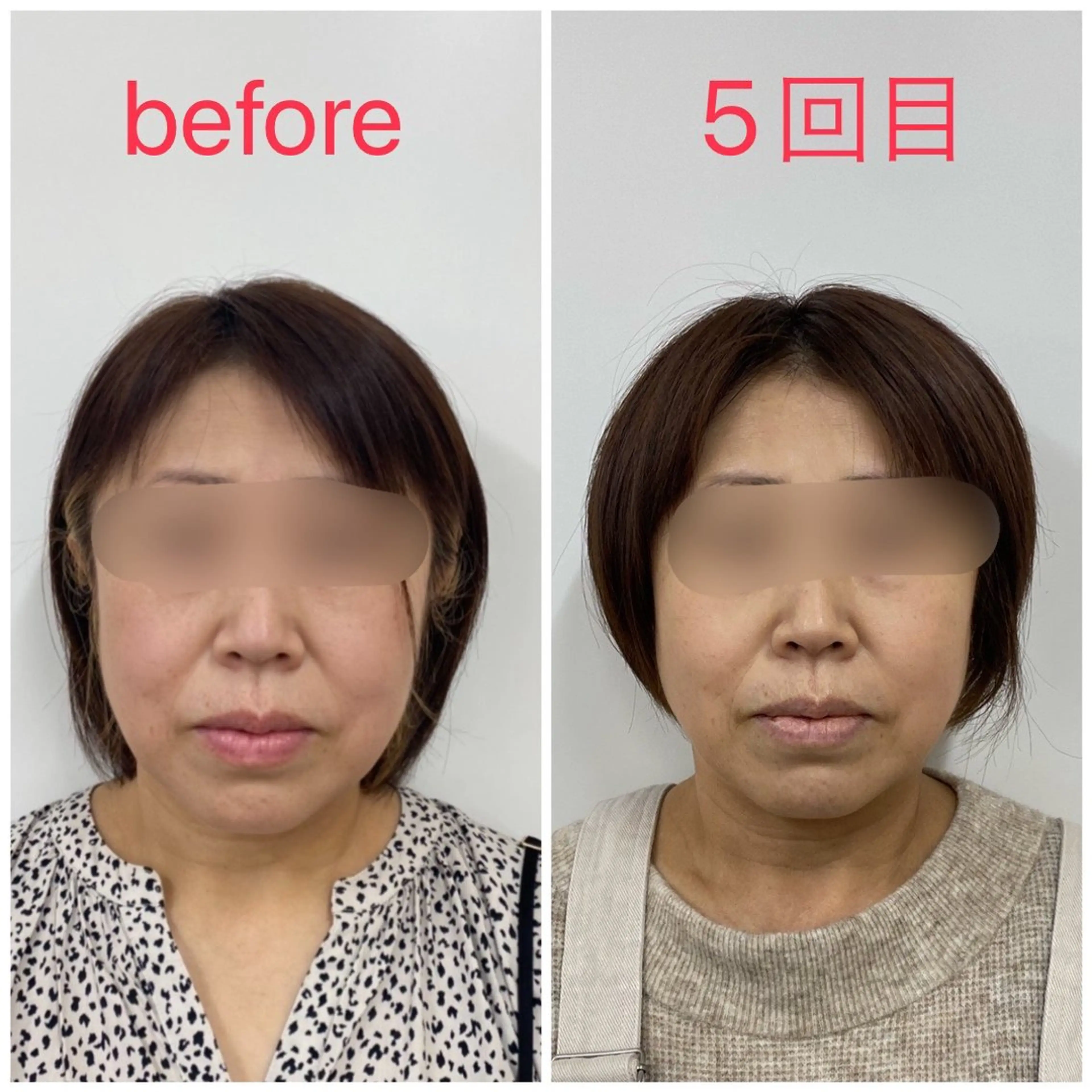 小顔矯正サロン Lilyのエステ・リラクイメージ