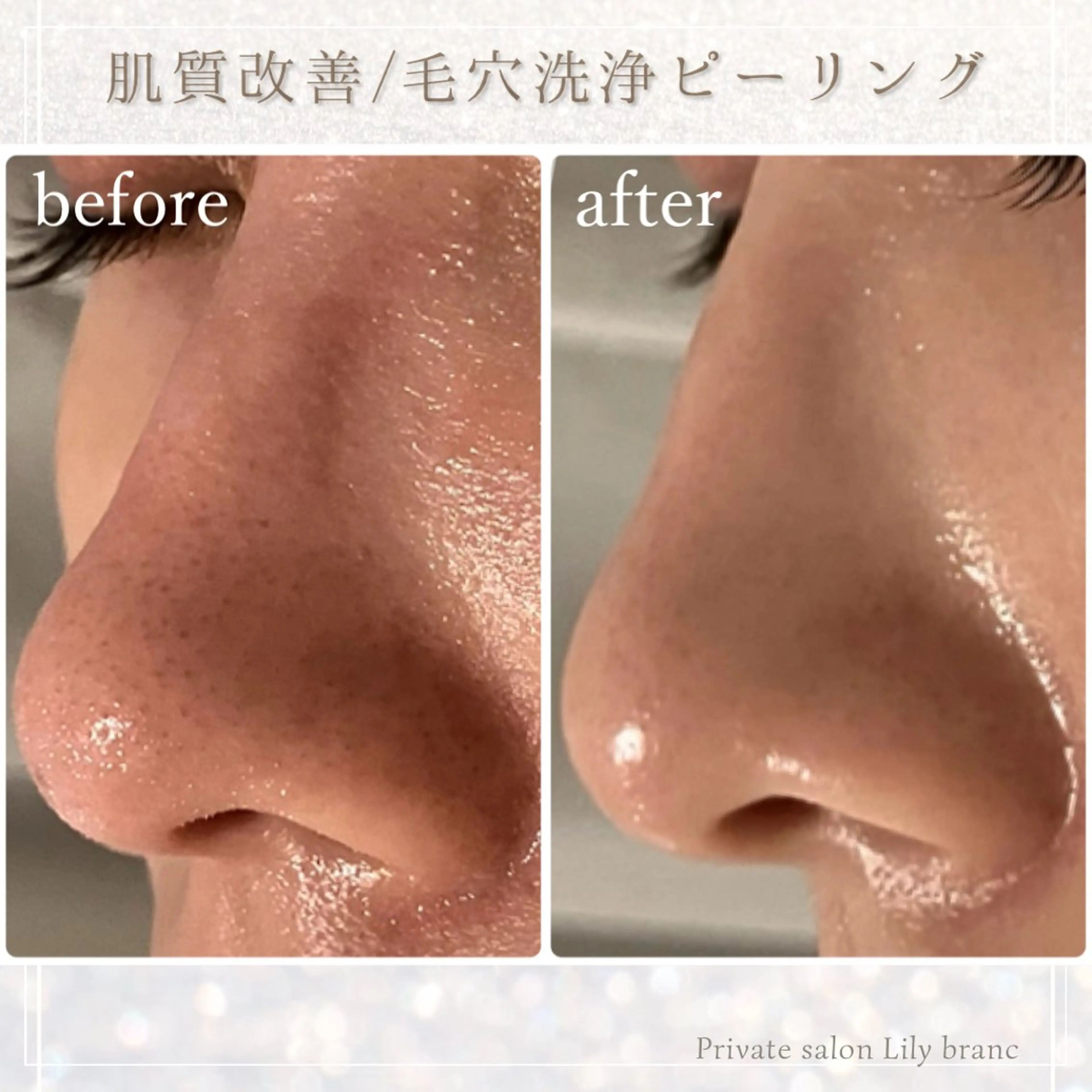 Lily branc 痩身/小顔/肌質改善のエステ・リラクイメージ