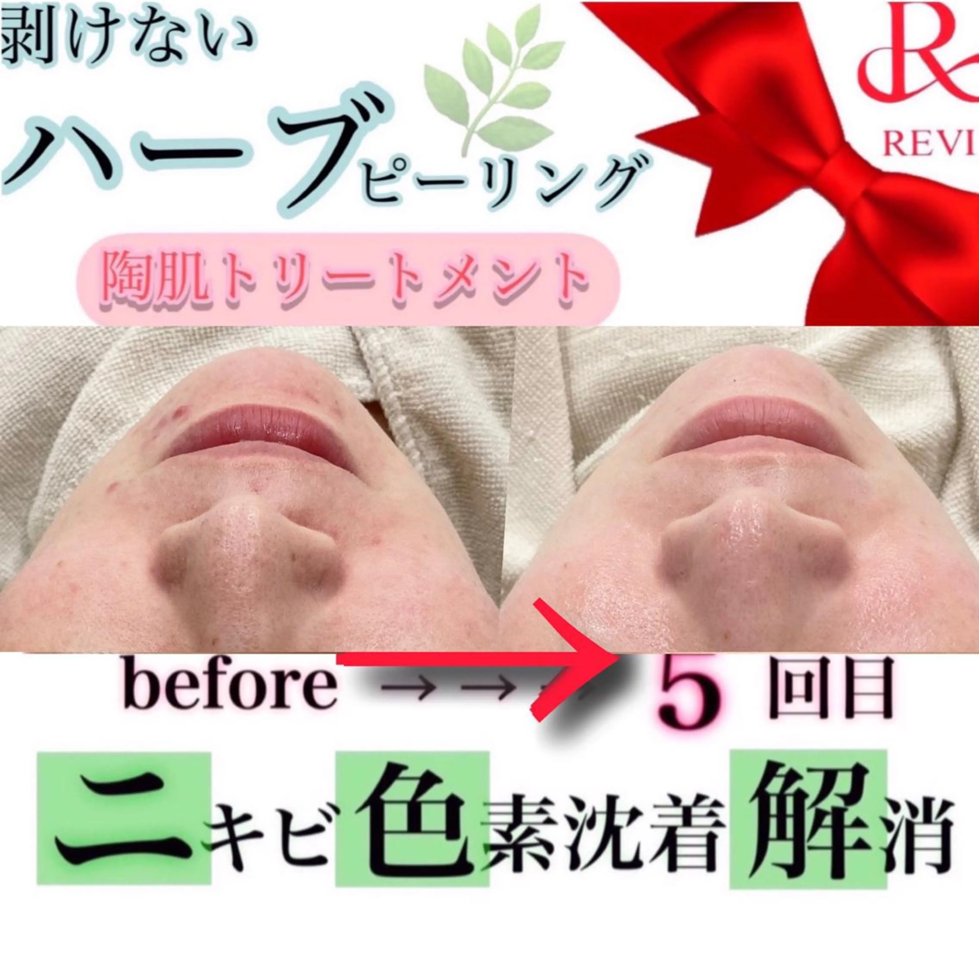 laluna saki...のその他イメージ