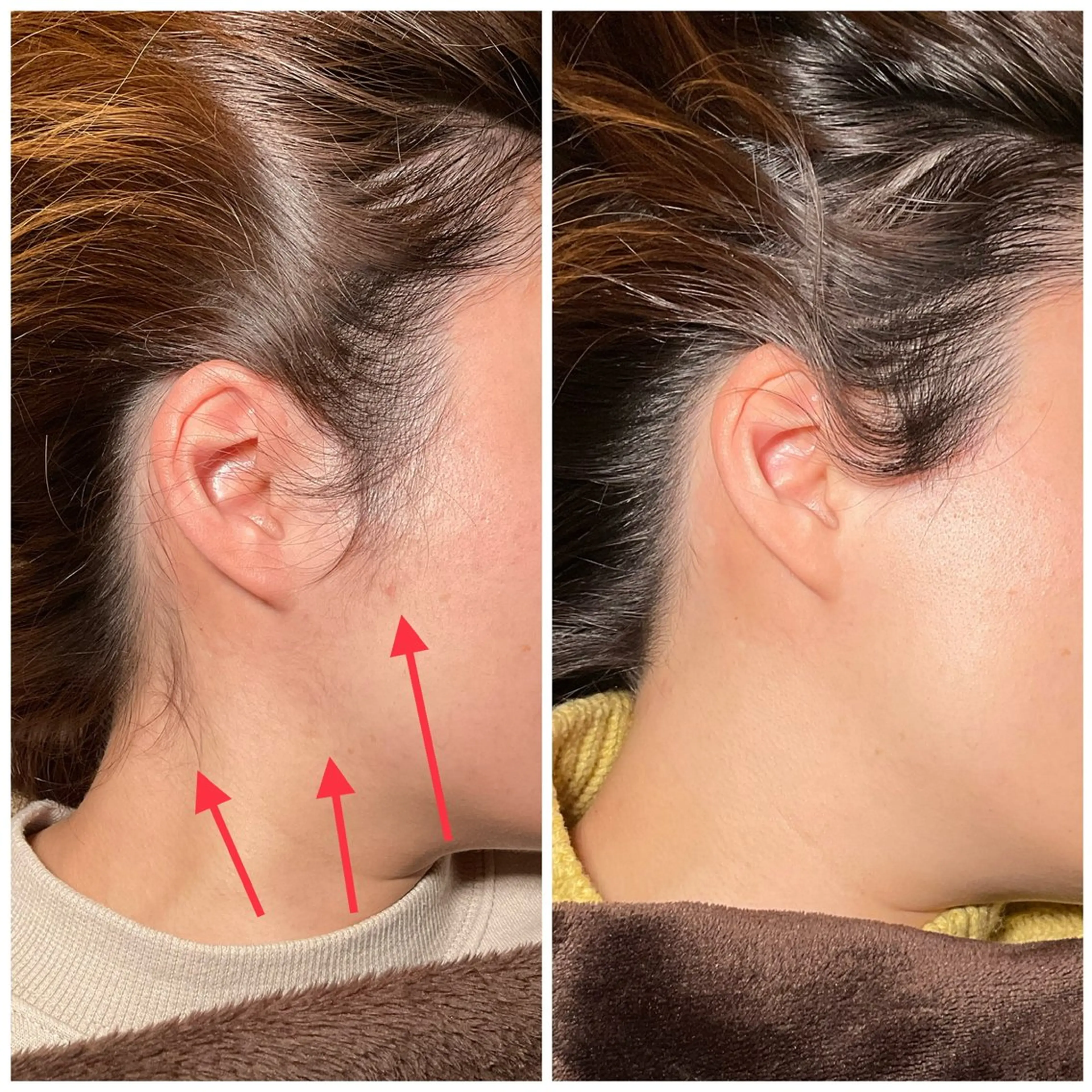 脱毛 Moki Amandaのエステ・リラクイメージ