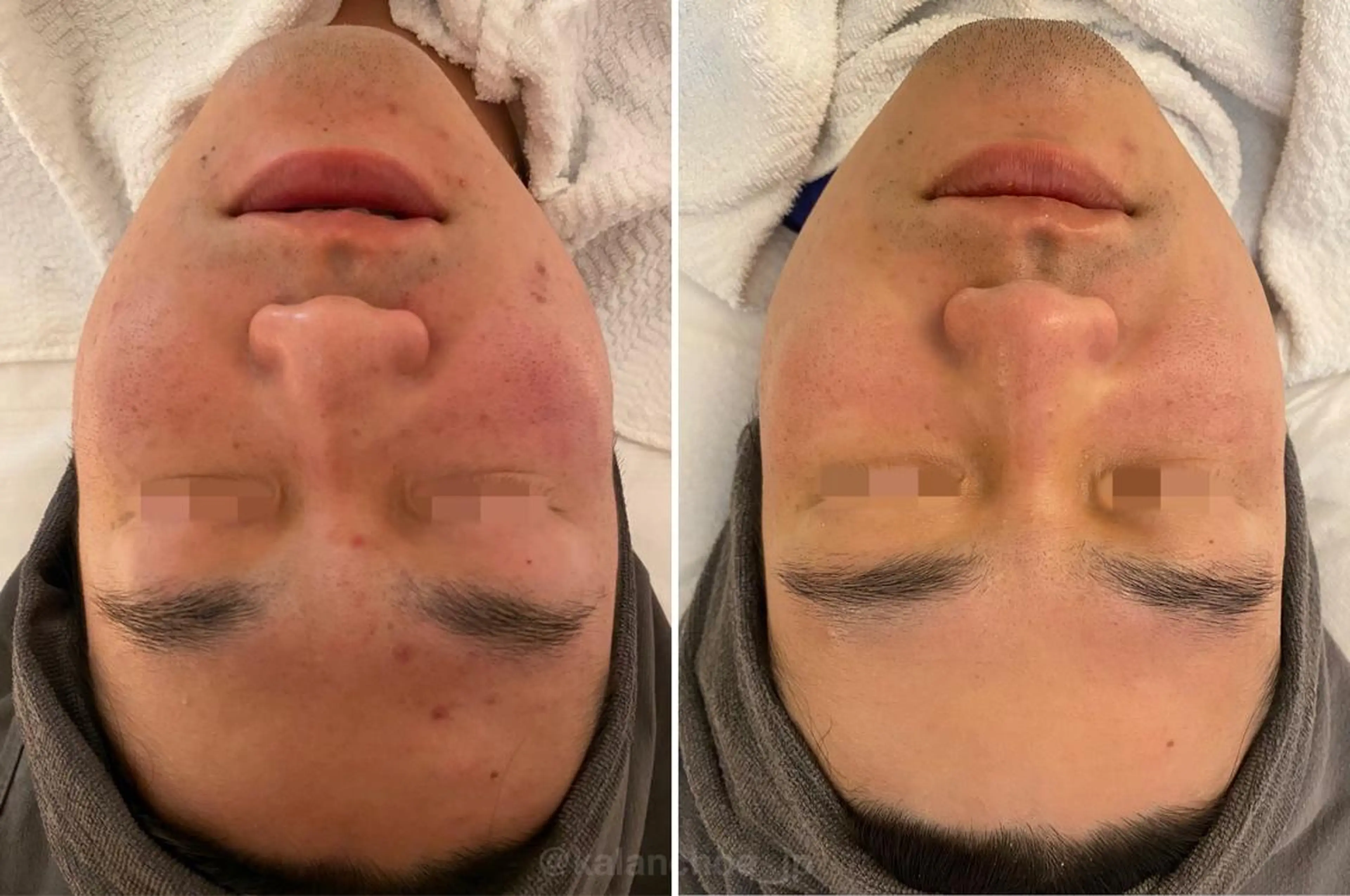 エステ 肌質改善 KALANCHOEのエステ・リラクイメージ