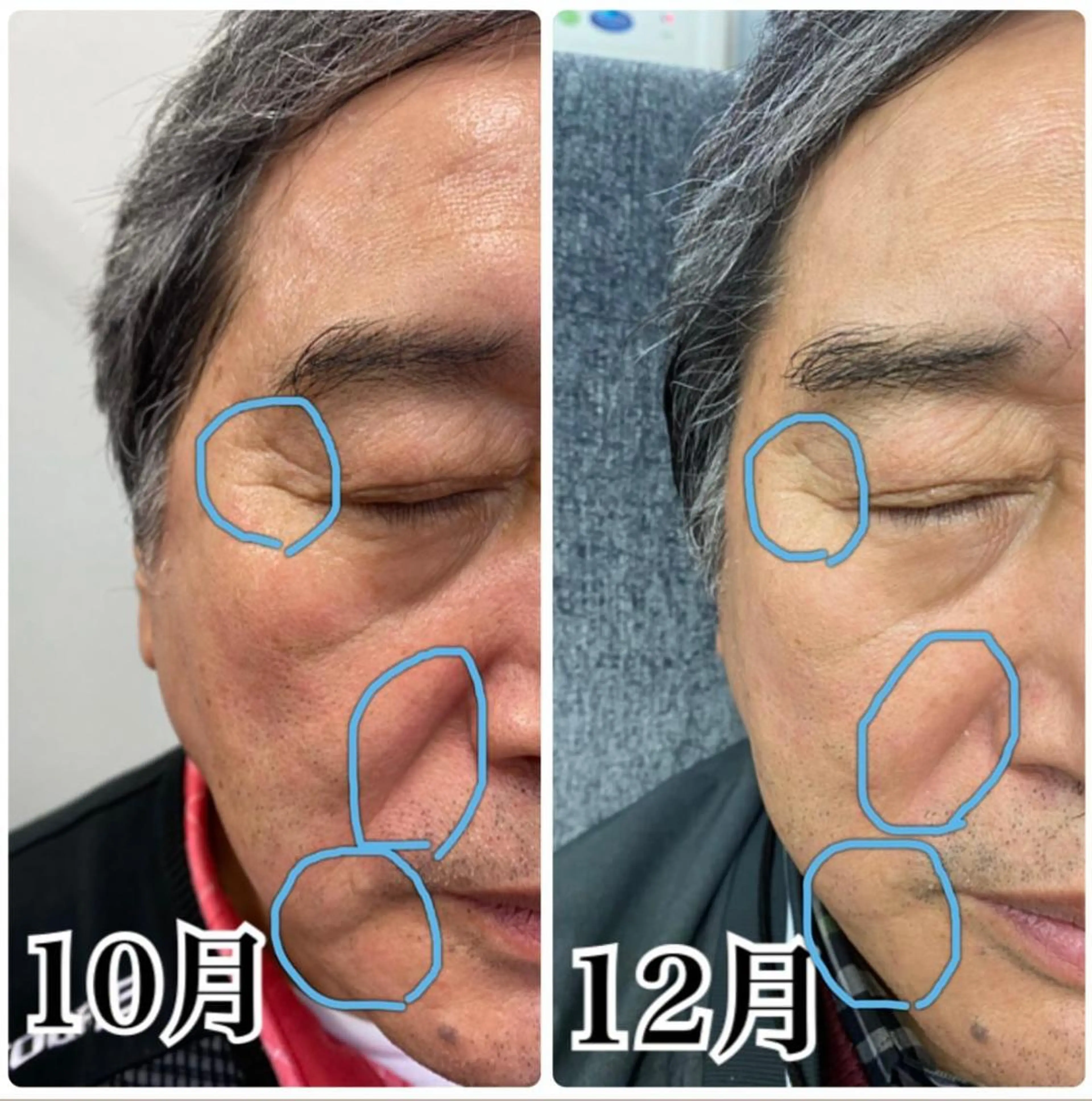 エステ Venus所属・エステサロン Venusのその他イメージ