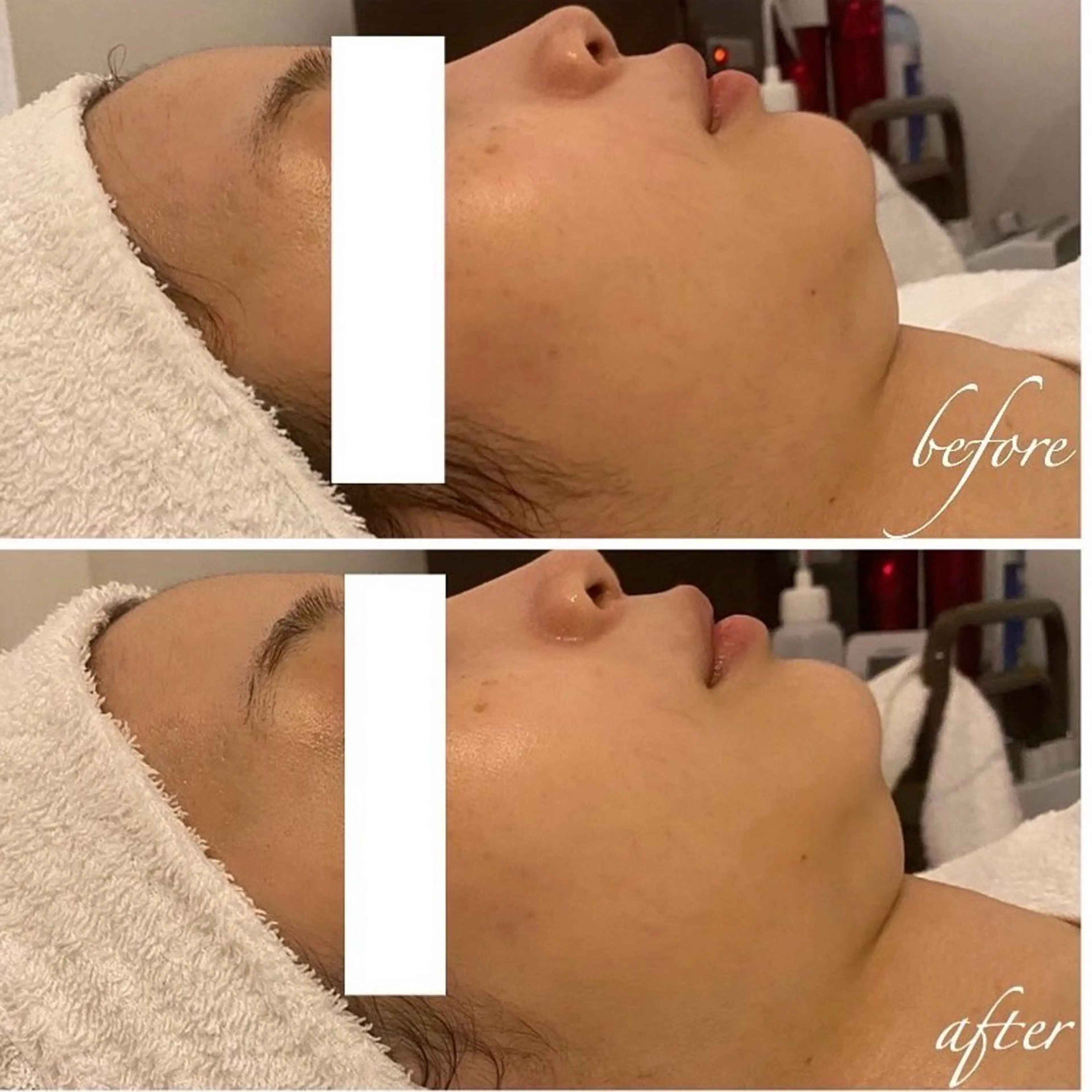 小顔マッサージ 毛穴/POLAのエステ・リラクイメージ