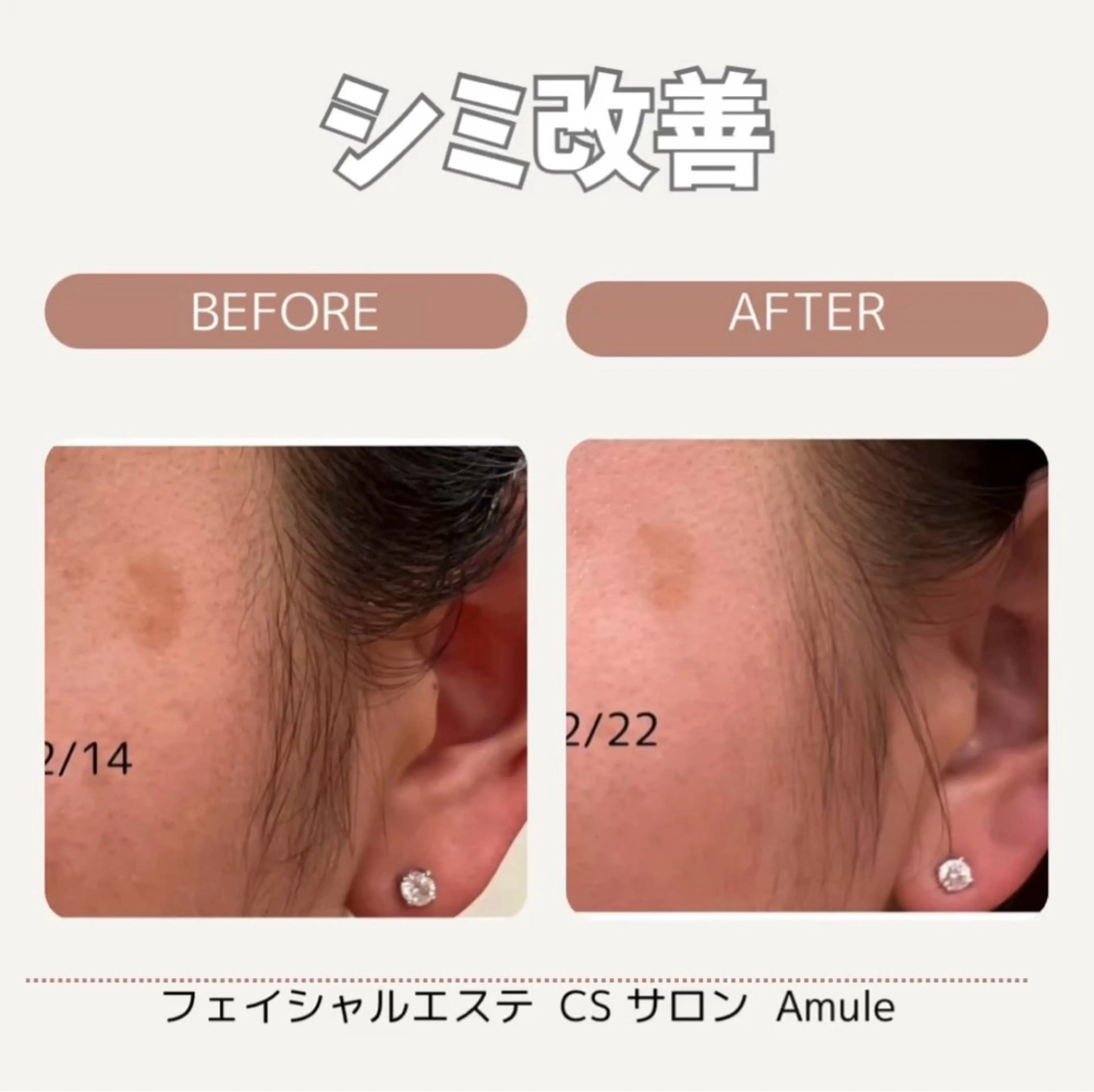 Amule anna🦋のエステ・リラクイメージ