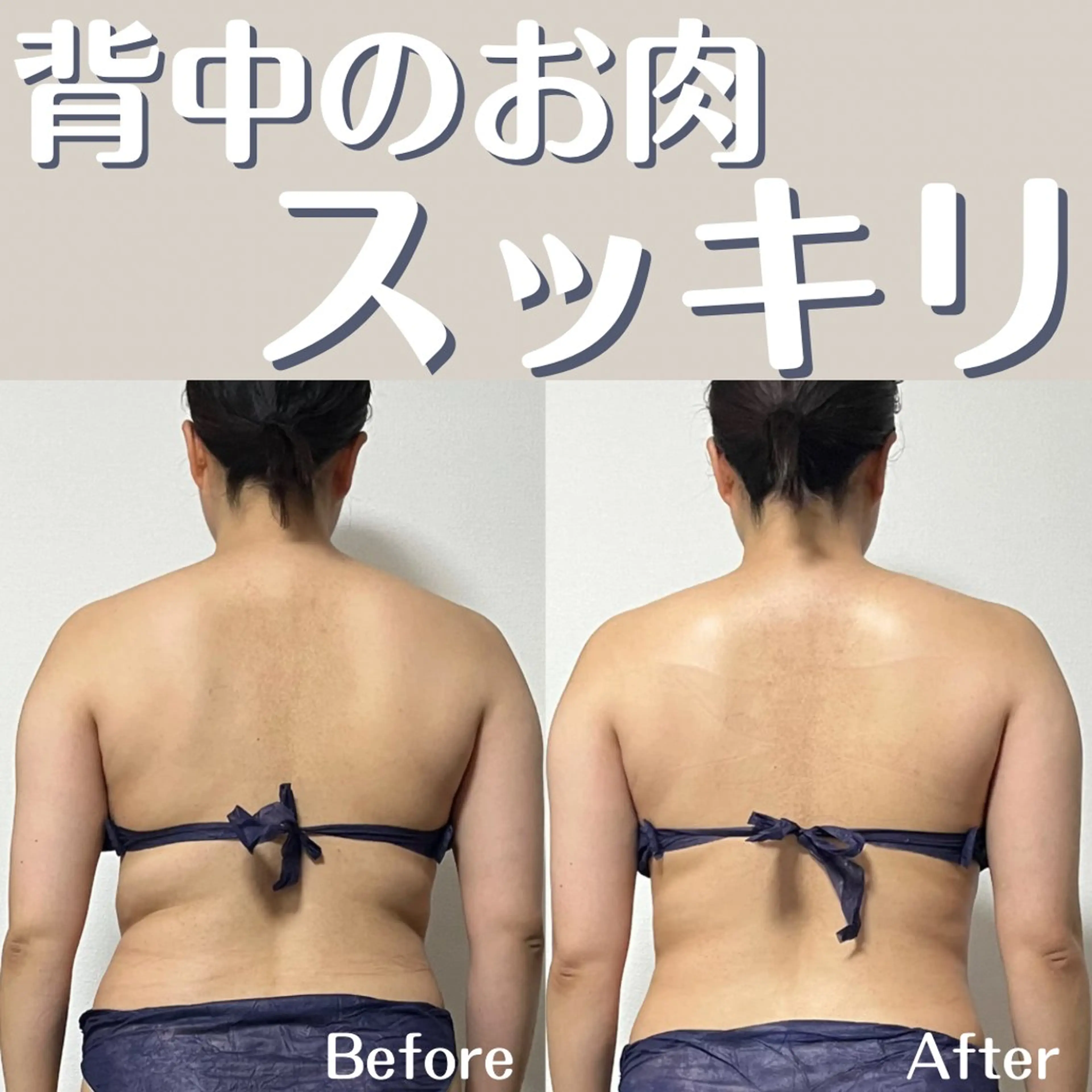 小顔矯正/骨格矯正 AKANEのエステ・リラクイメージ