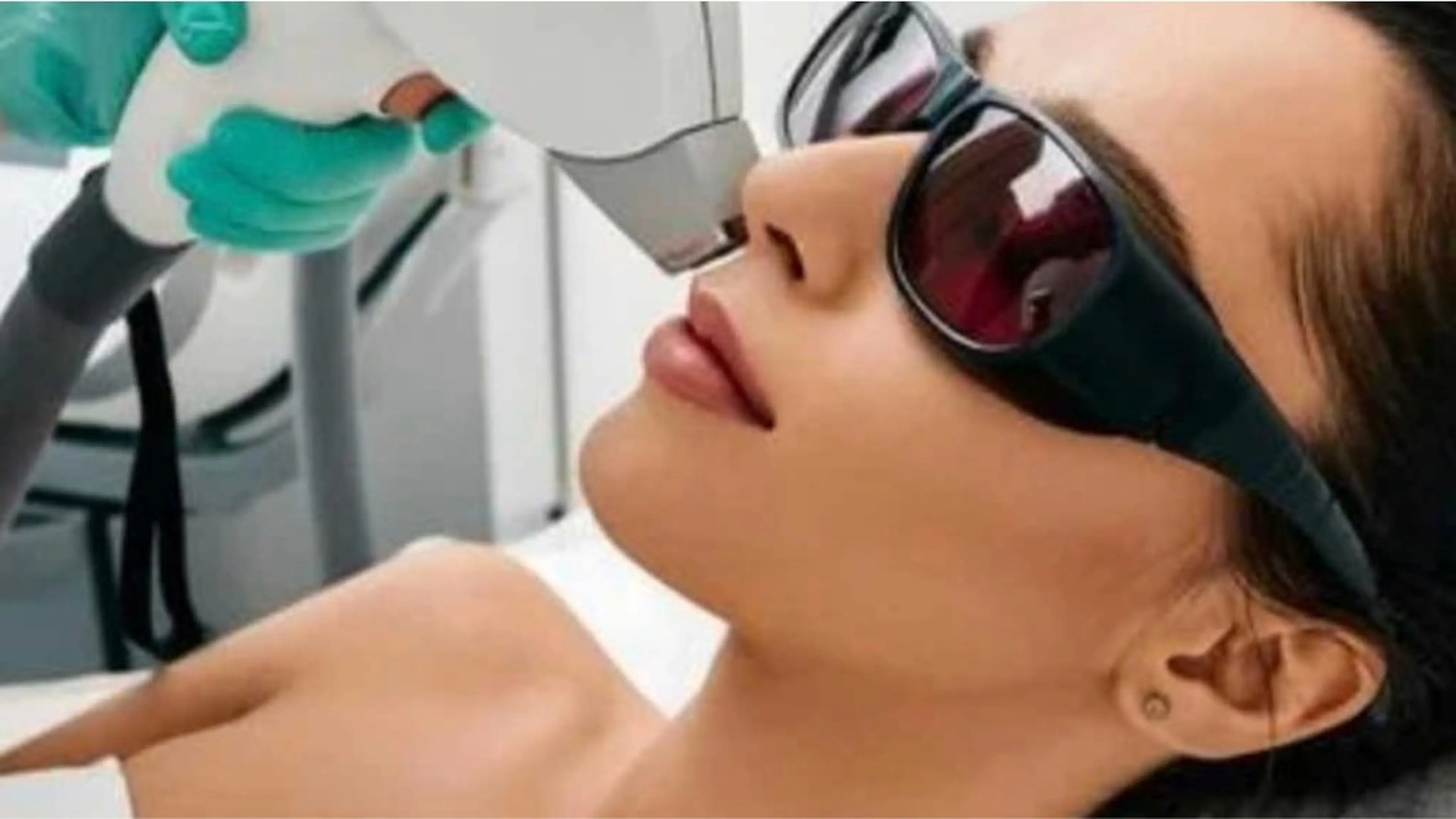 レディース顔脱毛の写真