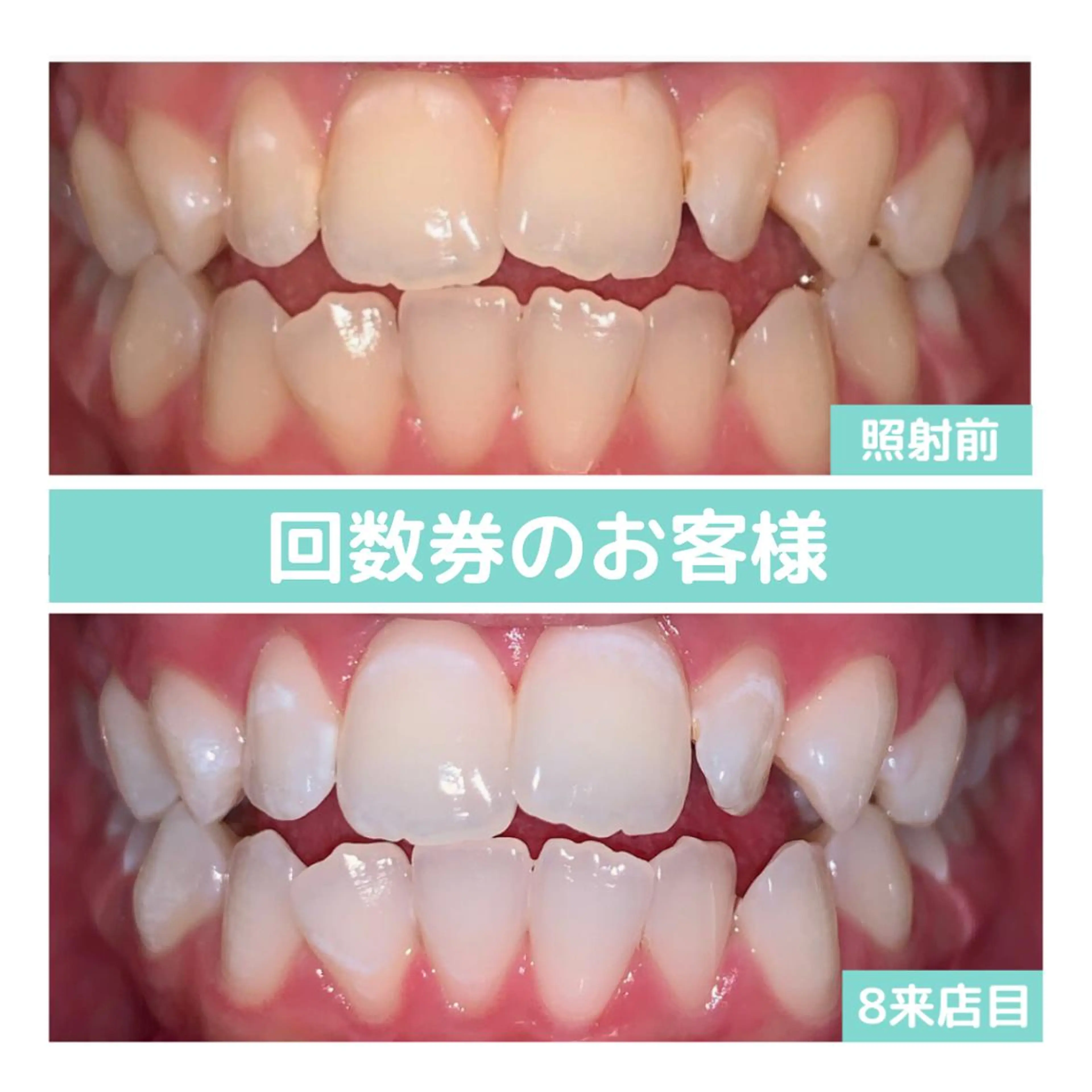 その他 韓国式3D毛穴洗浄 lonhanaのその他イメージ