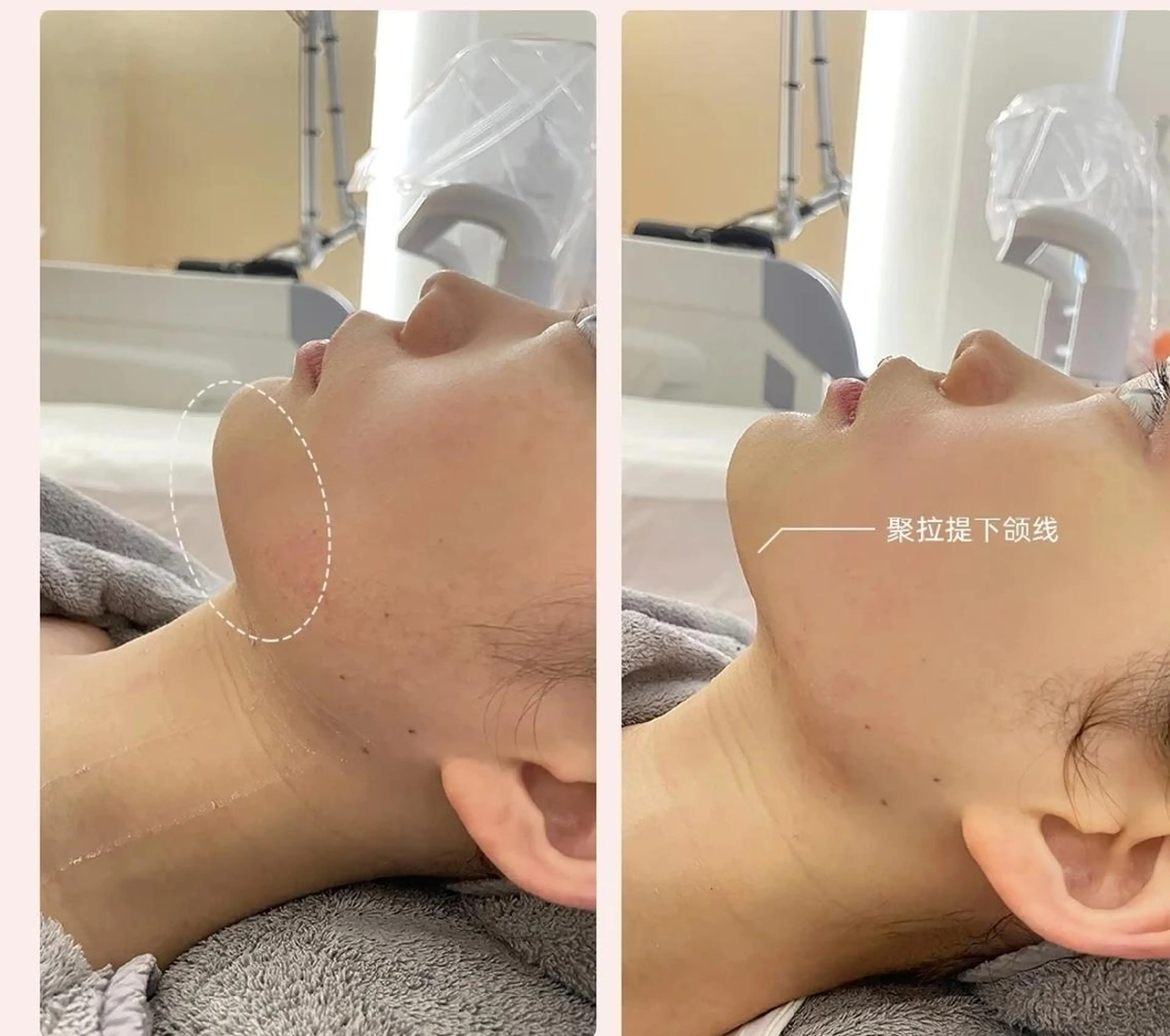 エステ aliaハーブ水光店 エステティシャン募集のエステ・リラクイメージ