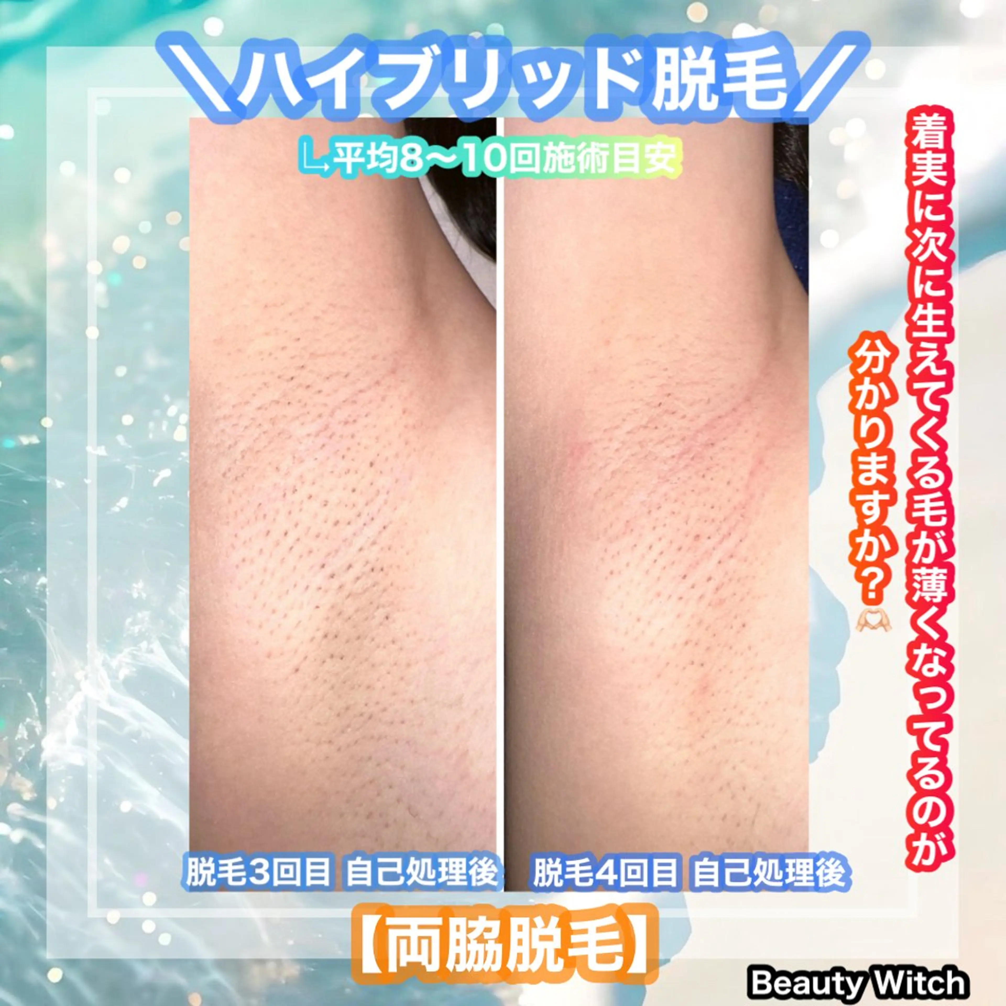 脱毛 痩身/脱毛/ネイル HARUKAのエステ・リラクイメージ