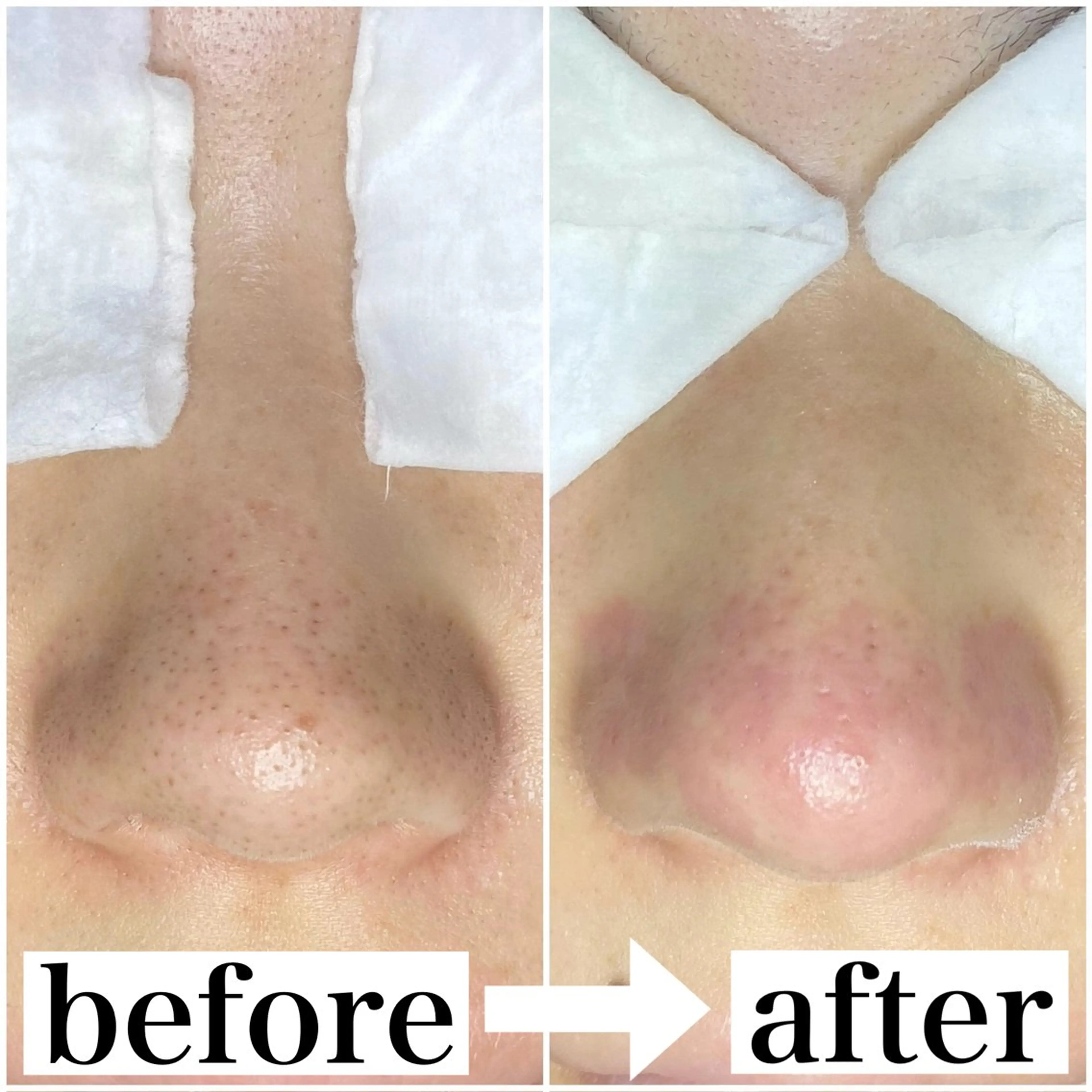 撮影モデル haruka .tのその他イメージ