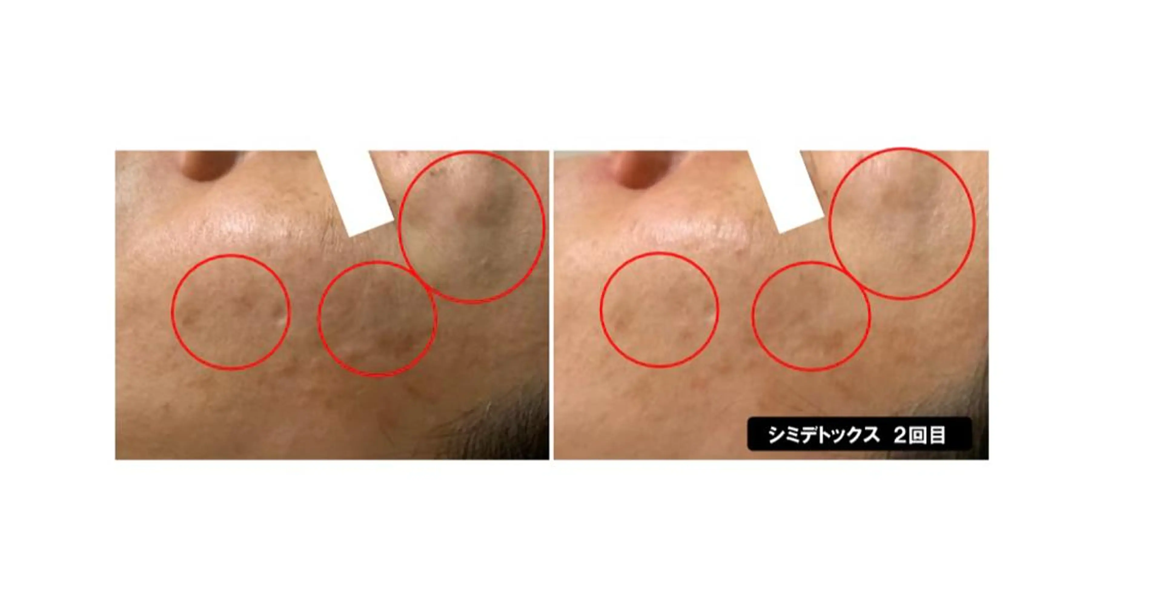 エステ ヴィーナス ビューティーのエステ・リラクイメージ