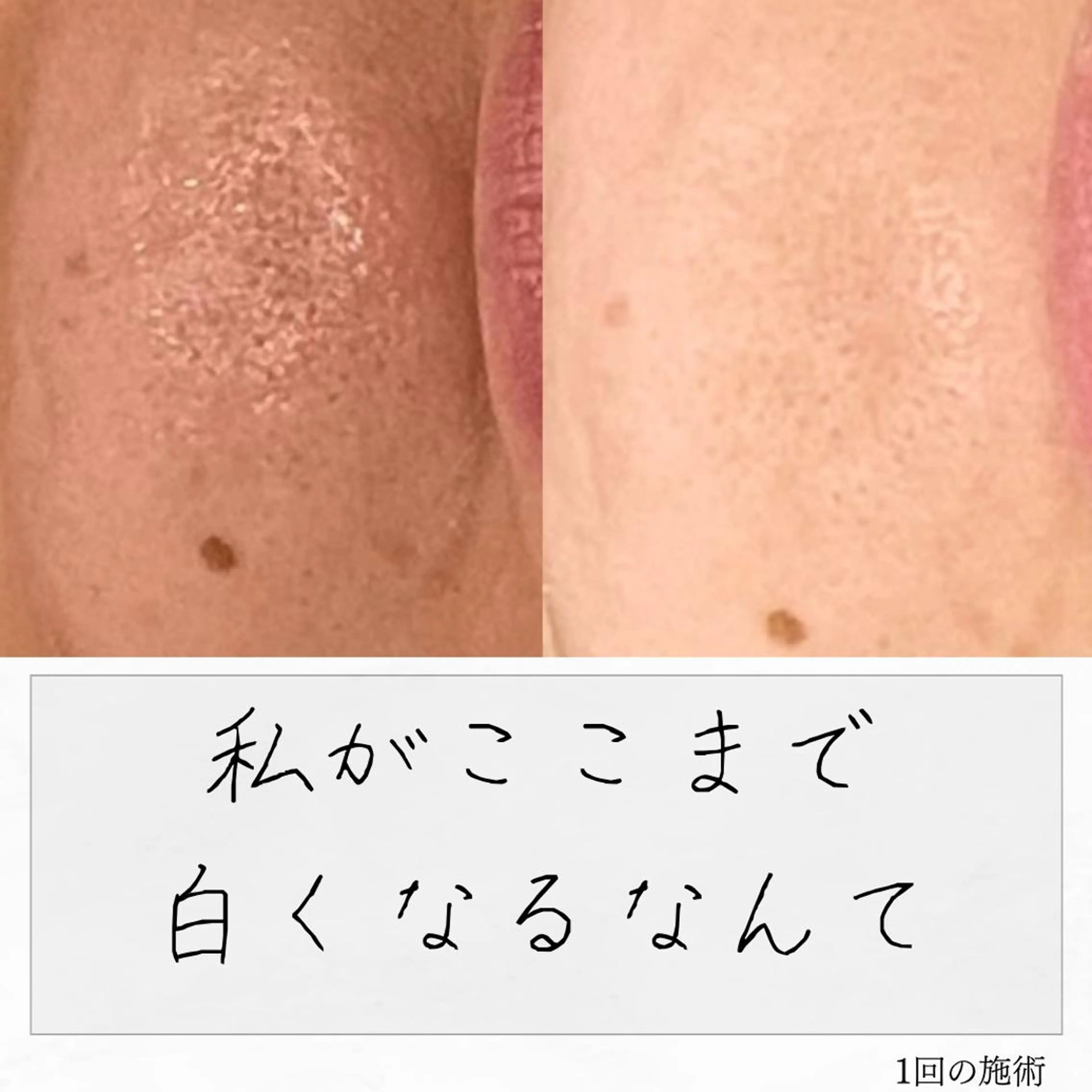 ニキビ経験者が施術 する専門サロン🌻のエステ・リラクイメージ