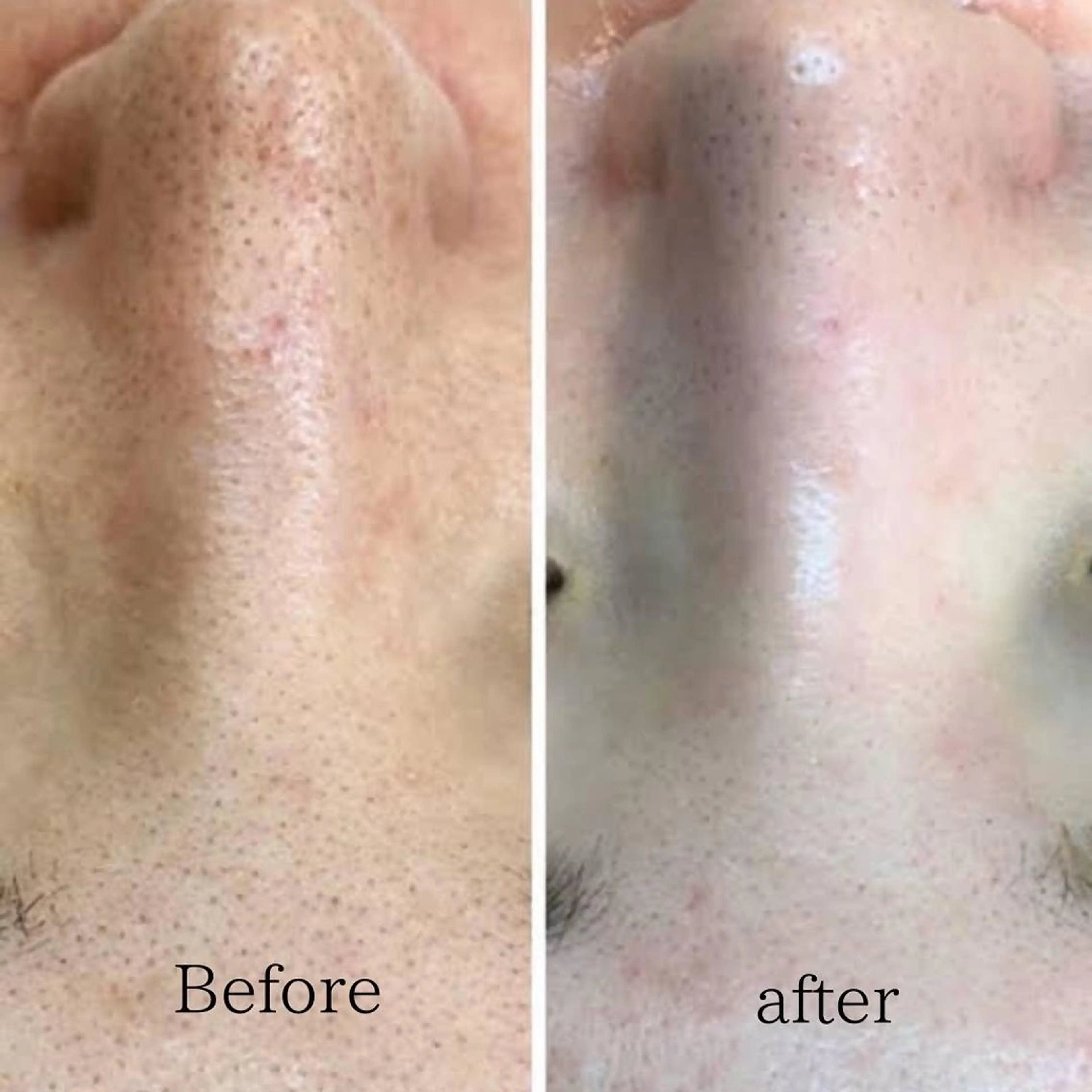 E LINDAのネイルデザイン