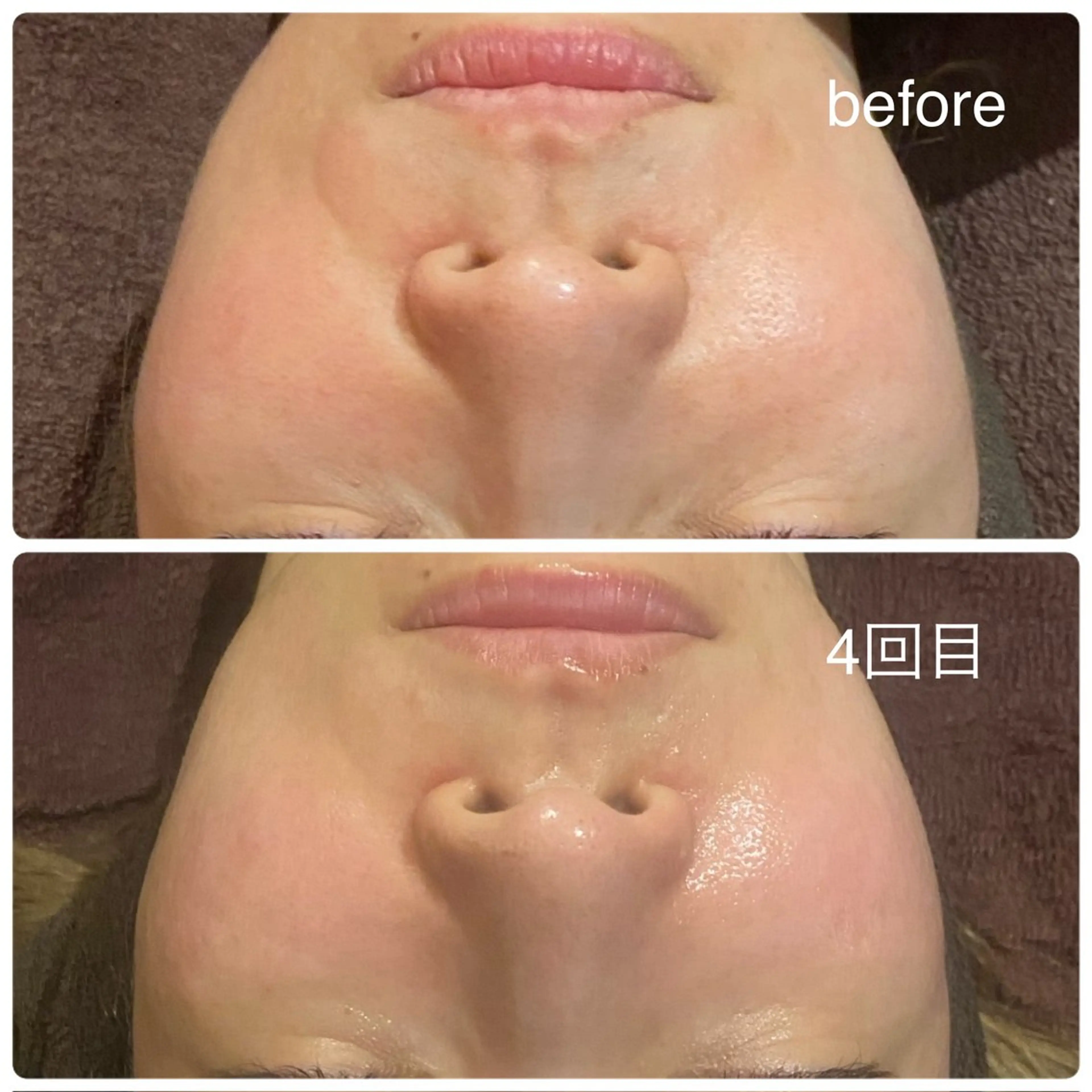 エステ terhibur 〜テルヒブール〜のエステ・リラクイメージ