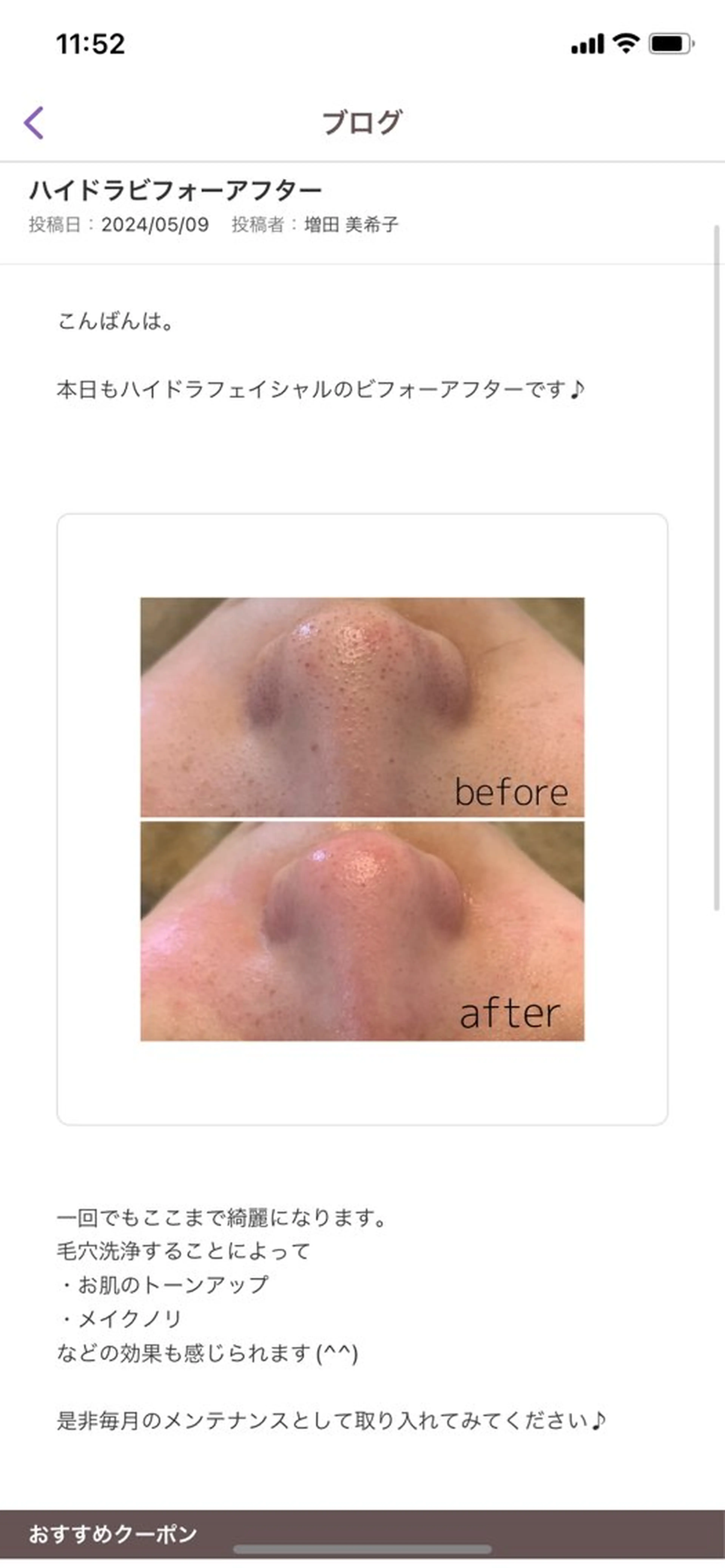 韓国肌管理 【毛穴専科】のエステ・リラクイメージ