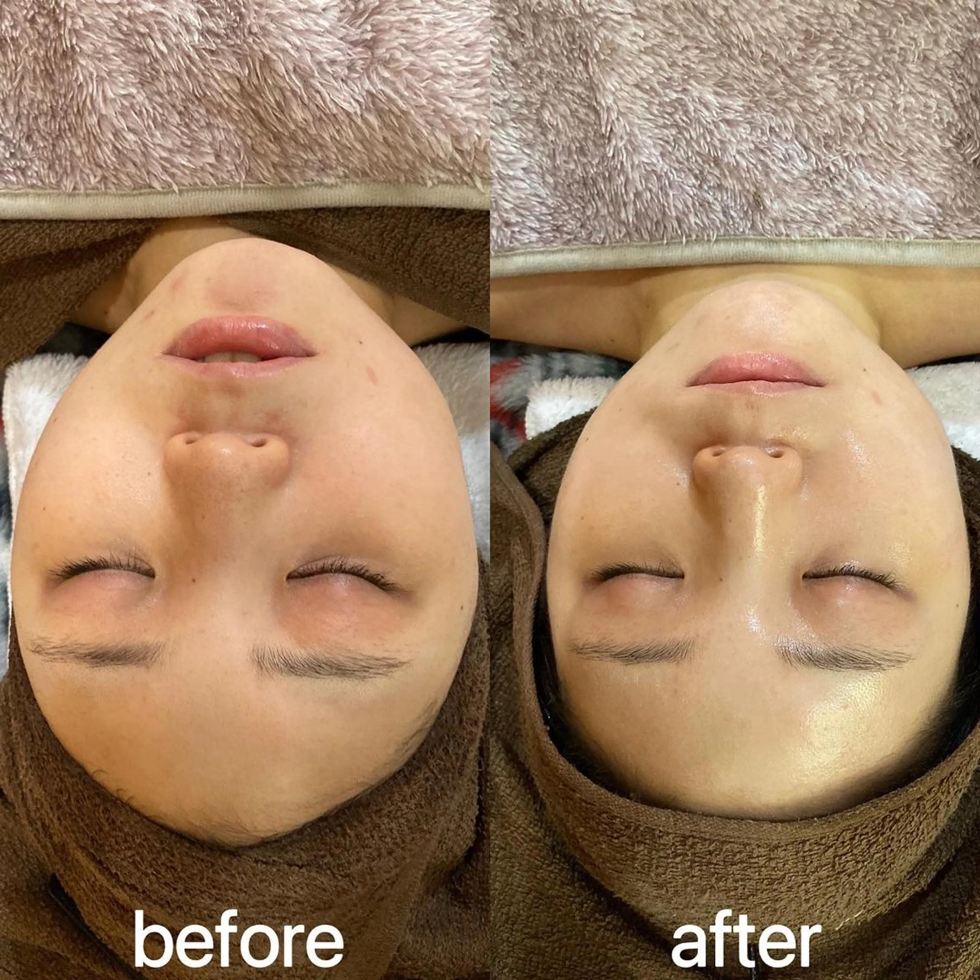 エステ Yuuki 陶肌トリートメントのエステ・リラクイメージ