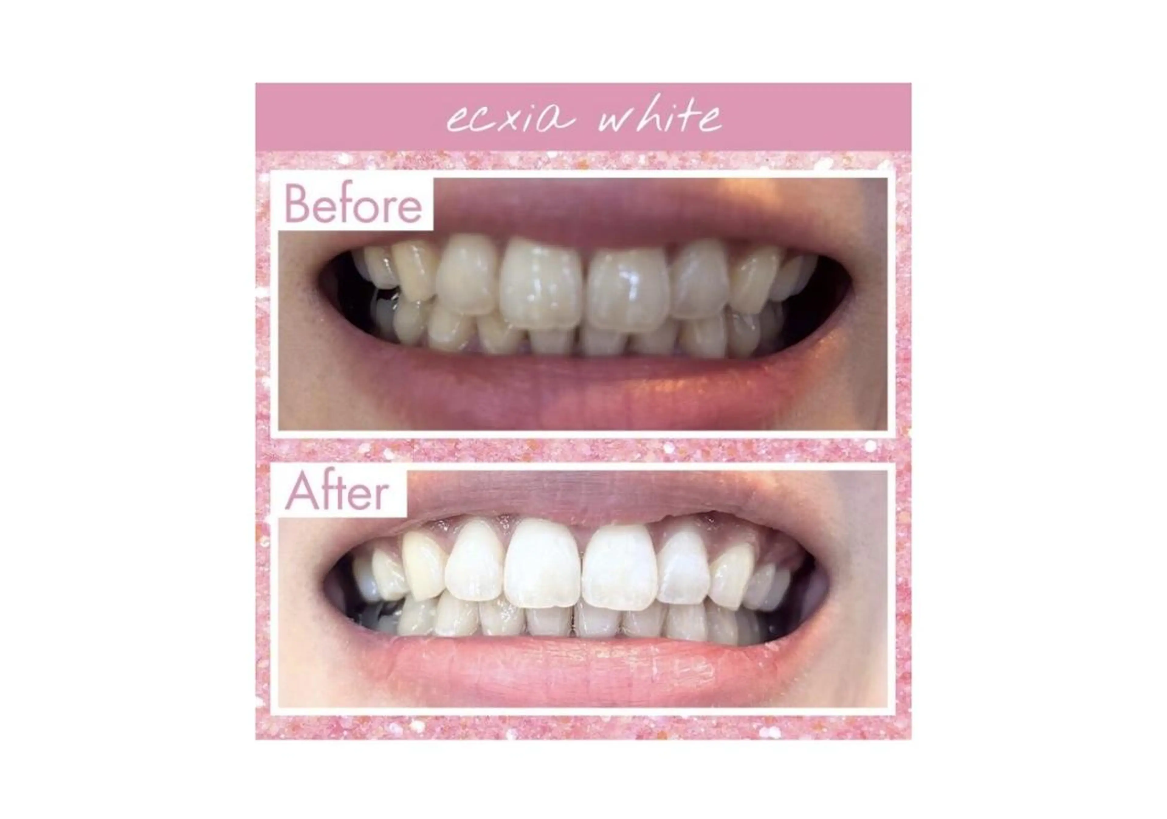 その他 セルフホワイトニング エクシア大阪梅田店のその他イメージ