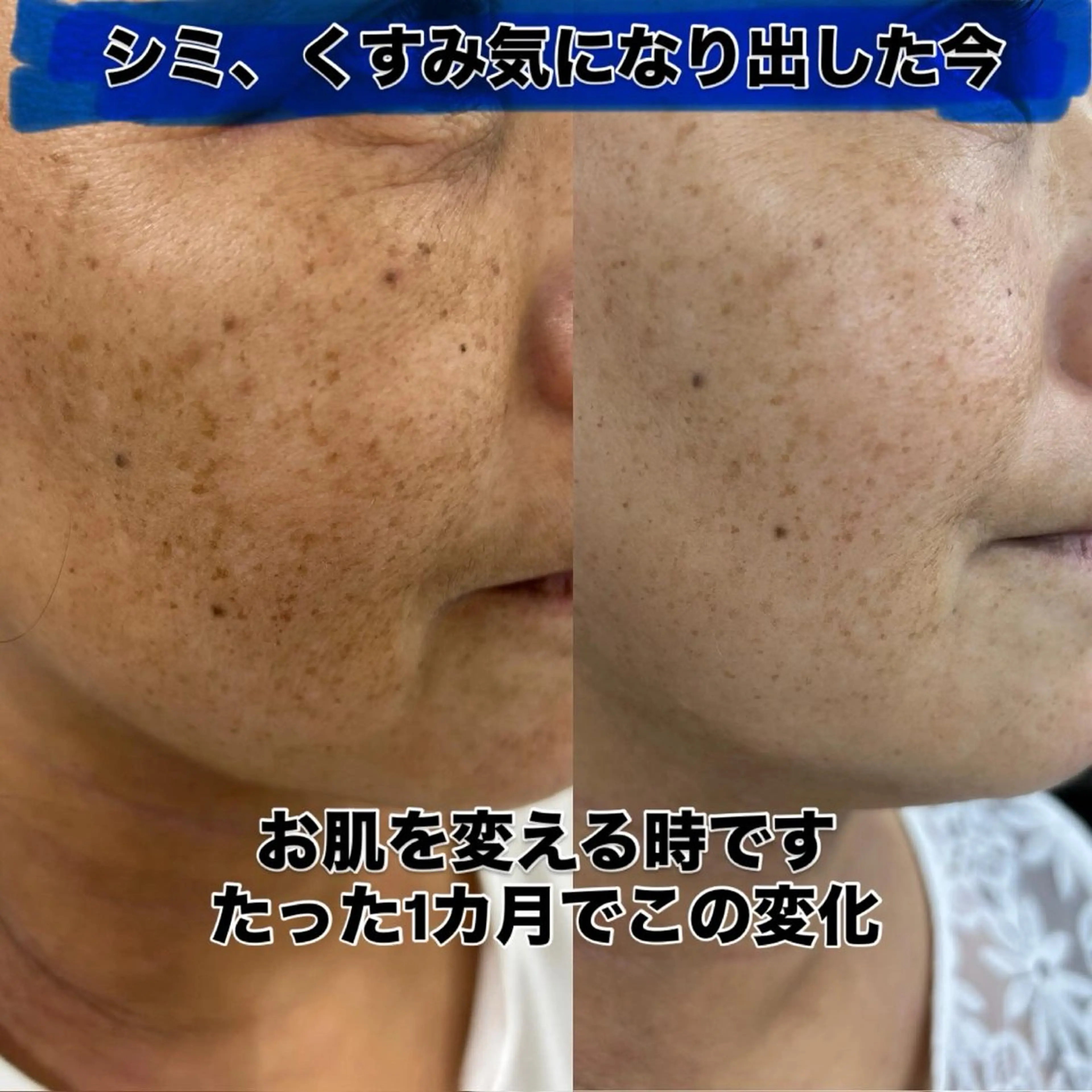 ナリス　デアイム西宮 辻　江梨那のエステ・リラクイメージ