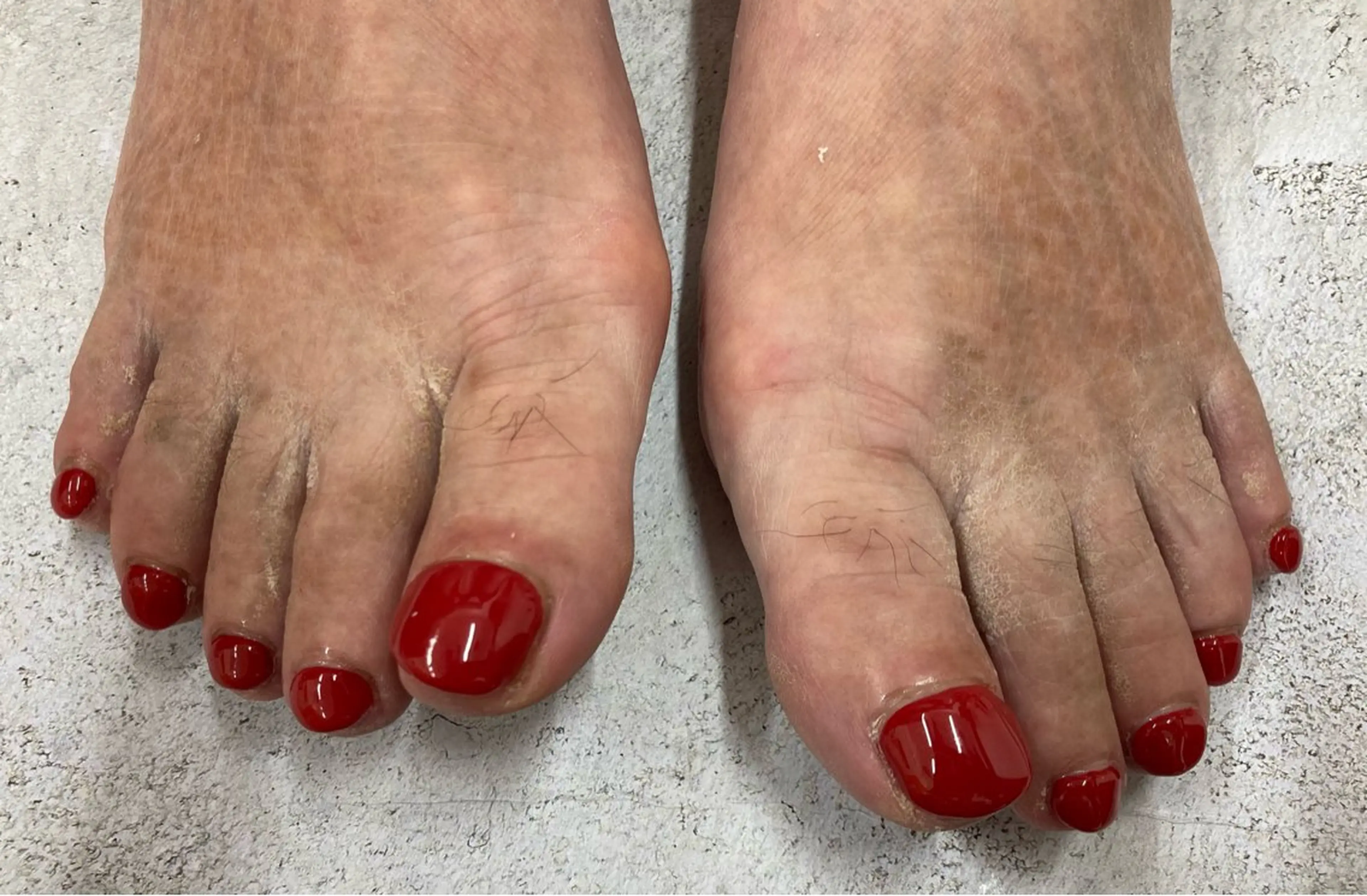 ネイル フットネイル ワンカラーネイル Maple saronのネイルデザイン