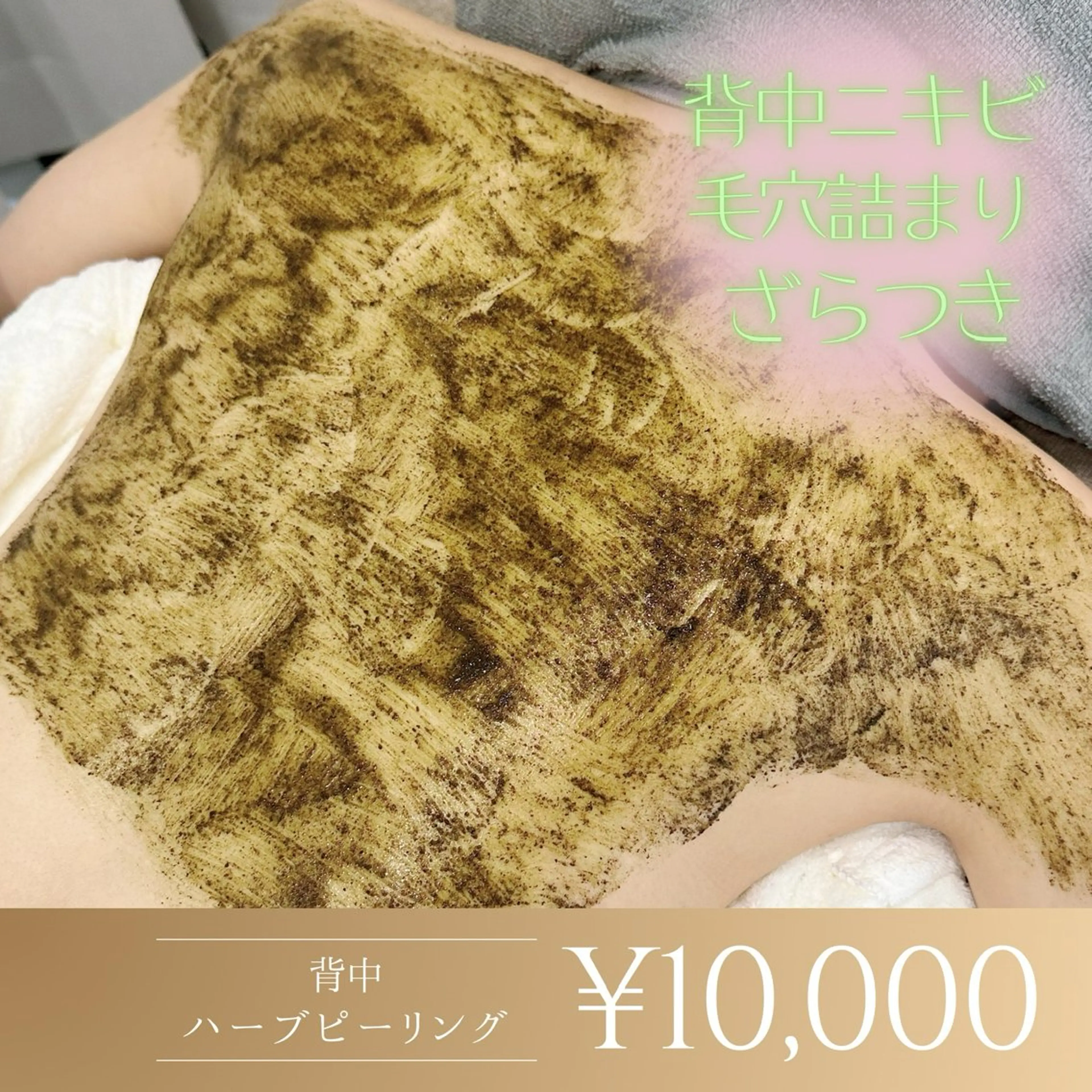 【背中ハーブピーリング🌿】剥離無し◎背中ニキビ、ザラザラ、黒ずみに♪鎮静ケア付！の写真