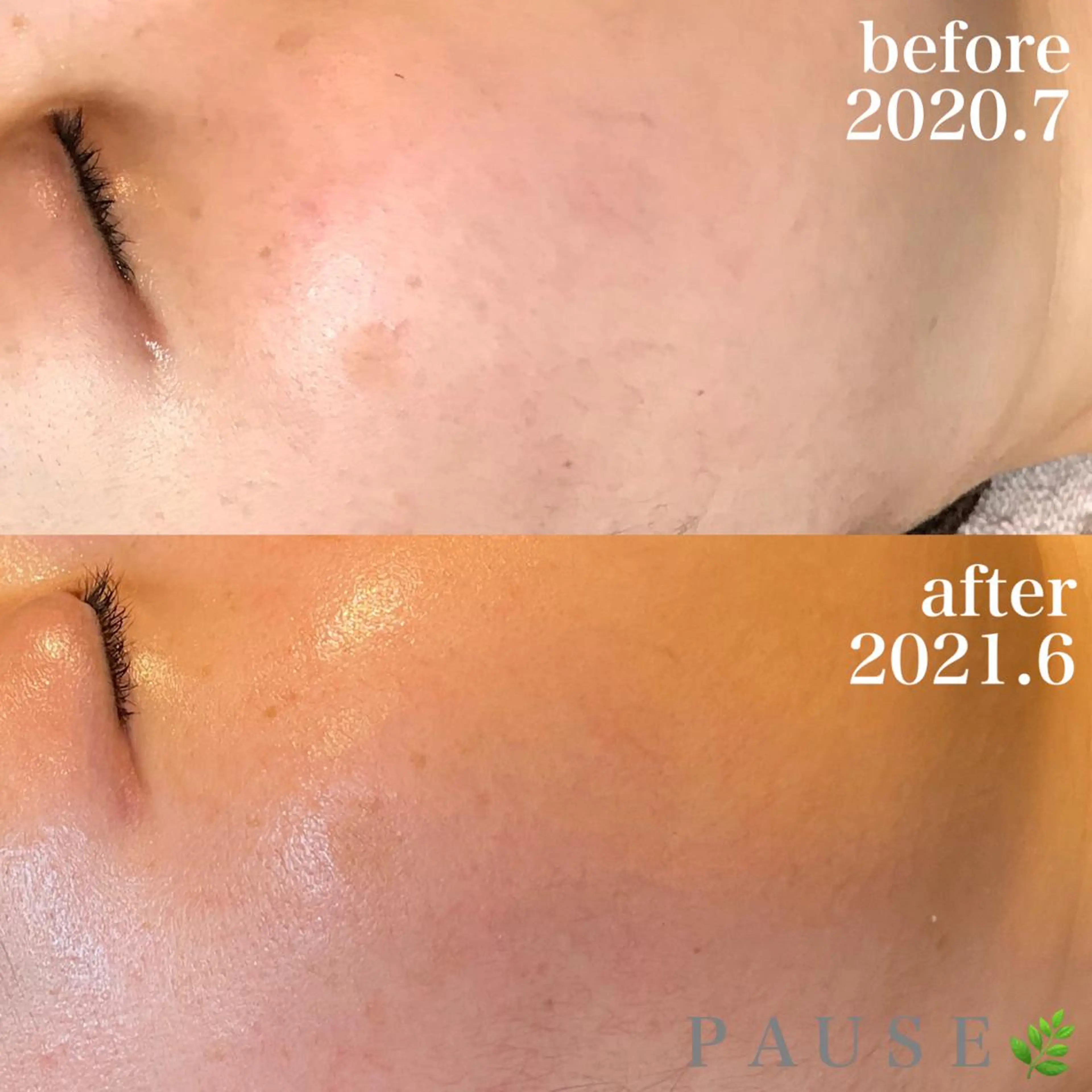 エステ 浜野 恵美のエステ・リラクイメージ