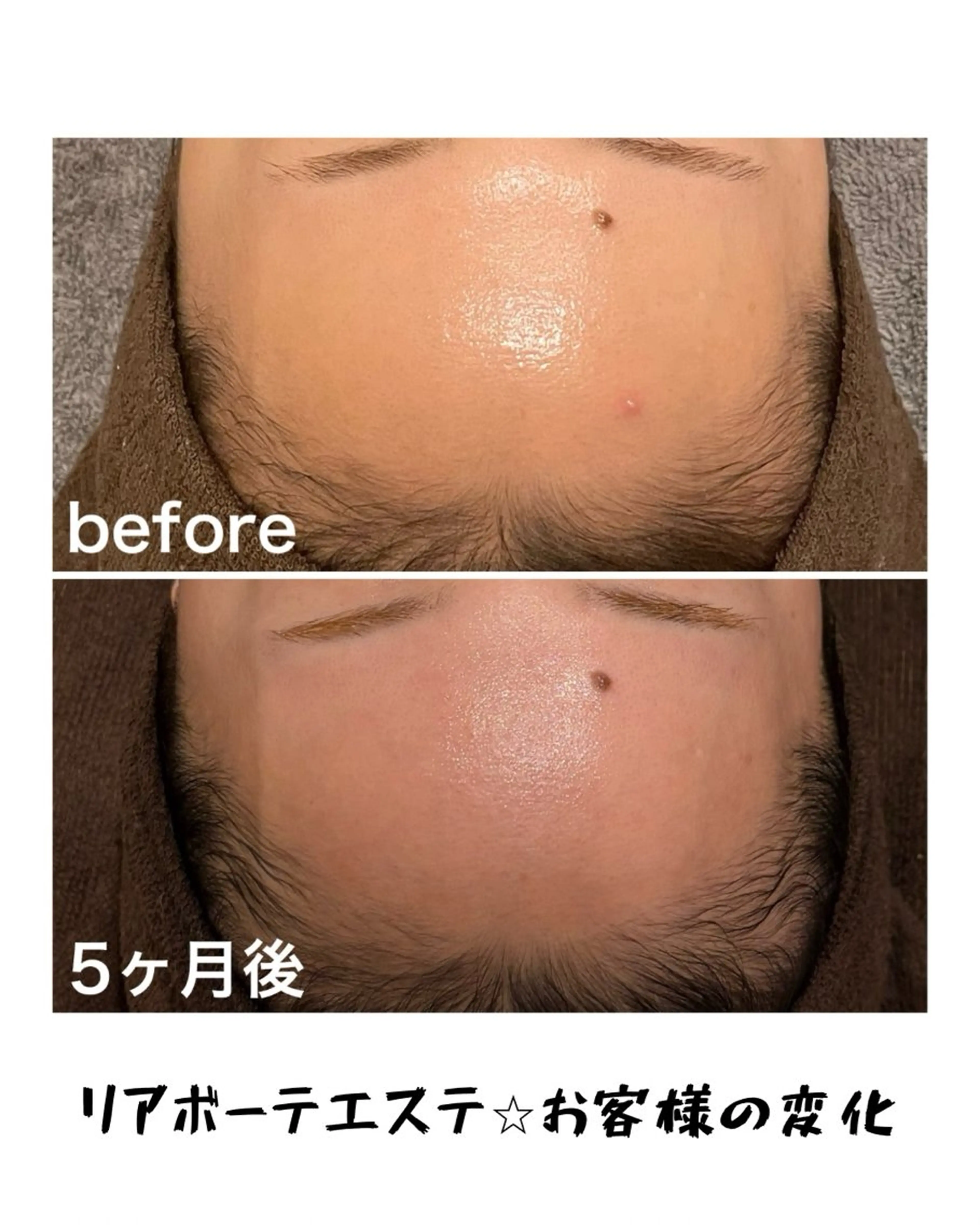 エステ 浜野 恵美のエステ・リラクイメージ