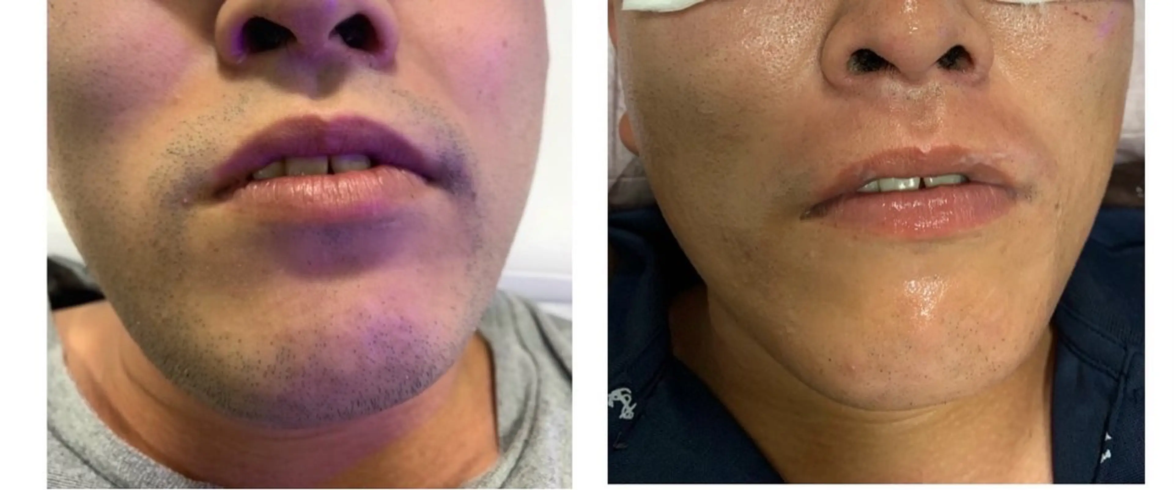 脱毛 Lumus Solarumのエステ・リラクイメージ