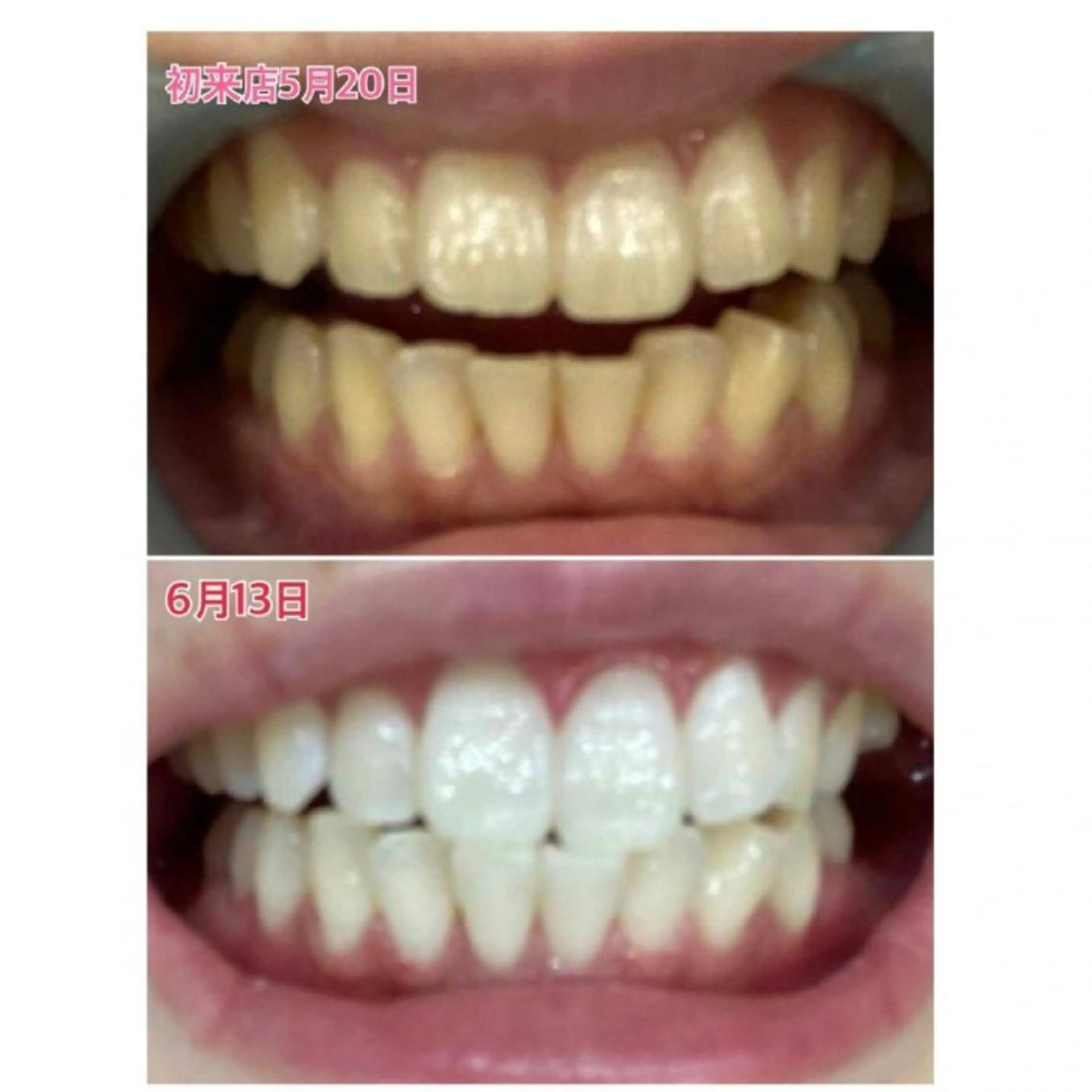 Ｍ渋谷 ホワイトニングのエステ・リラクイメージ