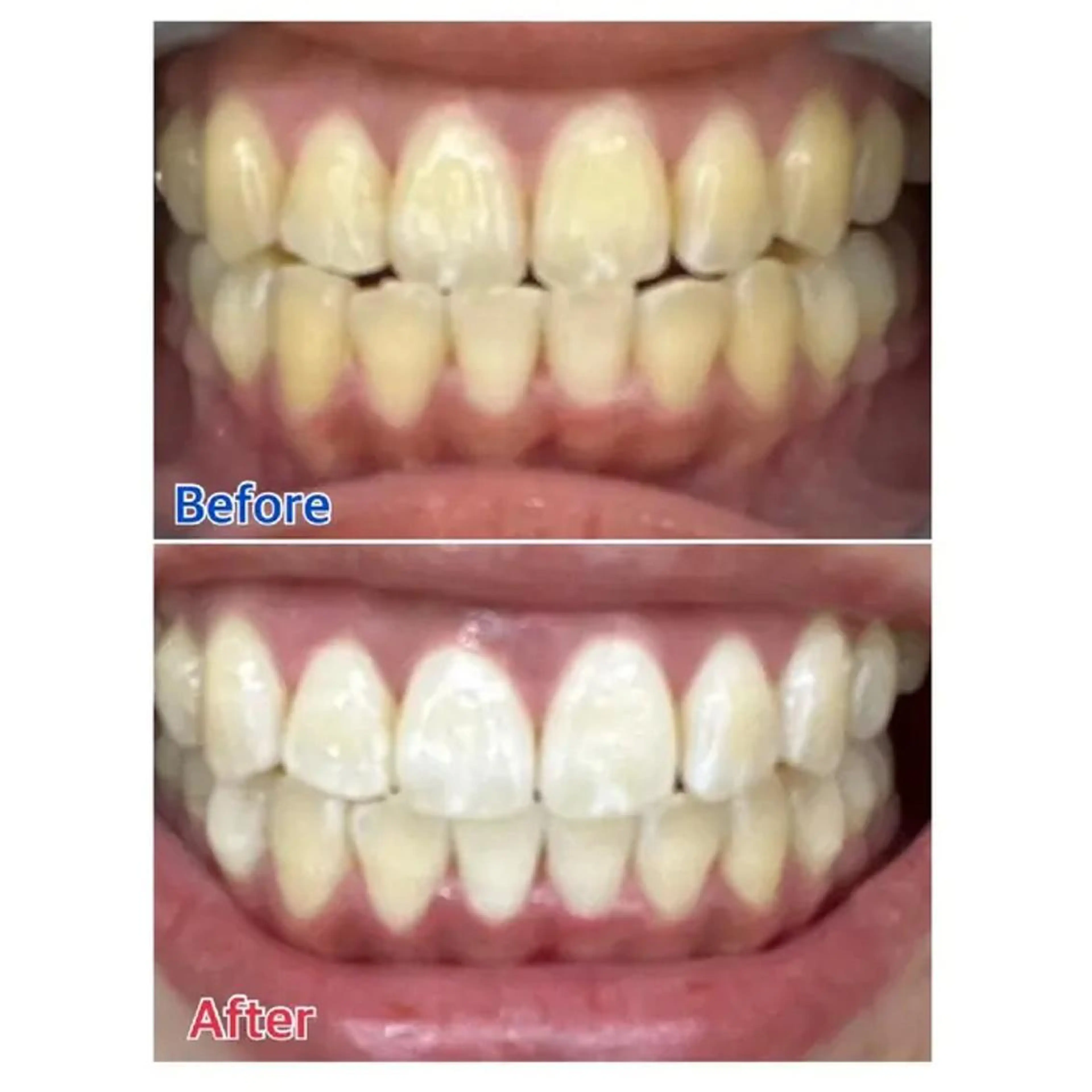 Ｍ渋谷 ホワイトニングのエステ・リラクイメージ