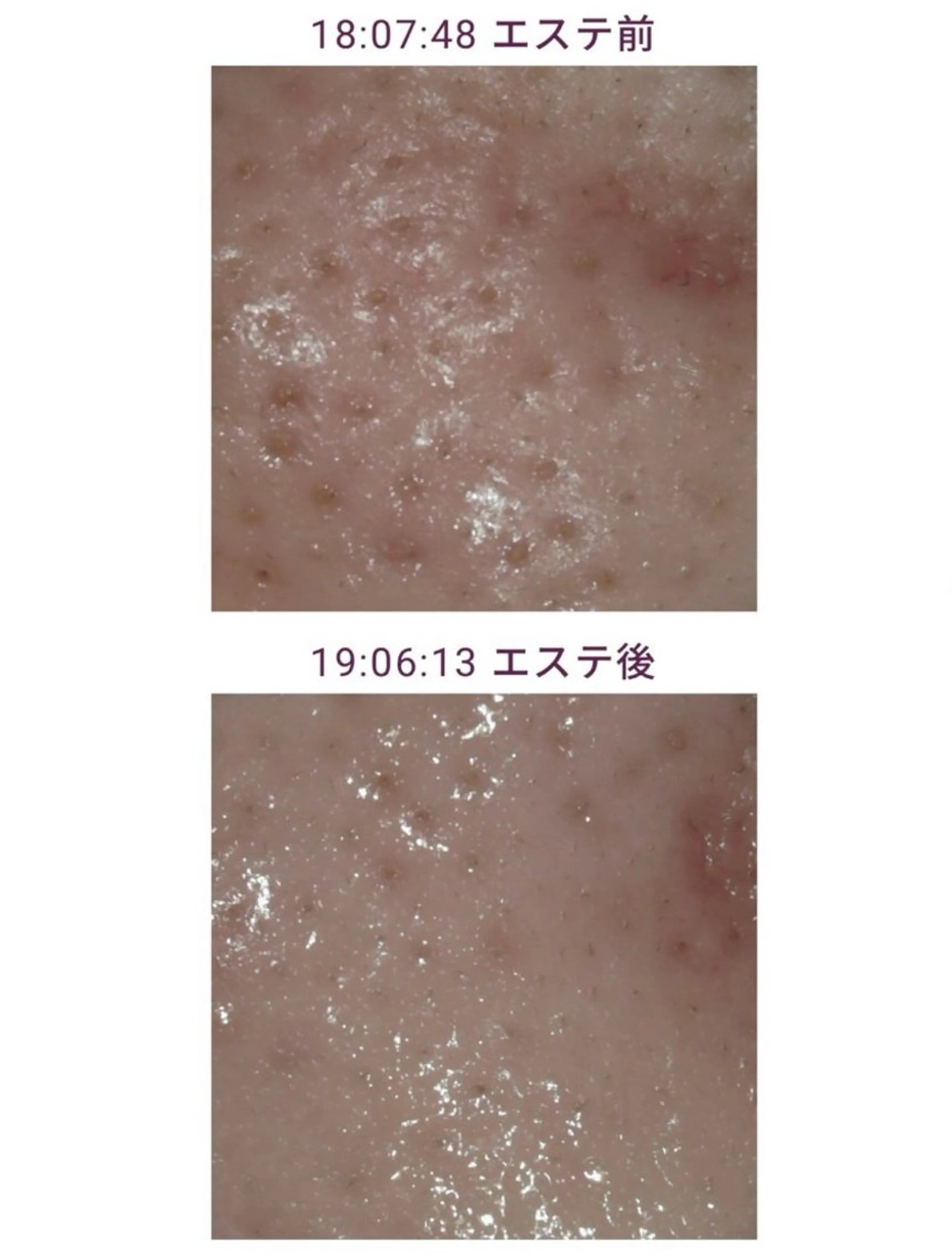 丸の内ヒルズ 鈴木麻瑚のエステ・リラクイメージ