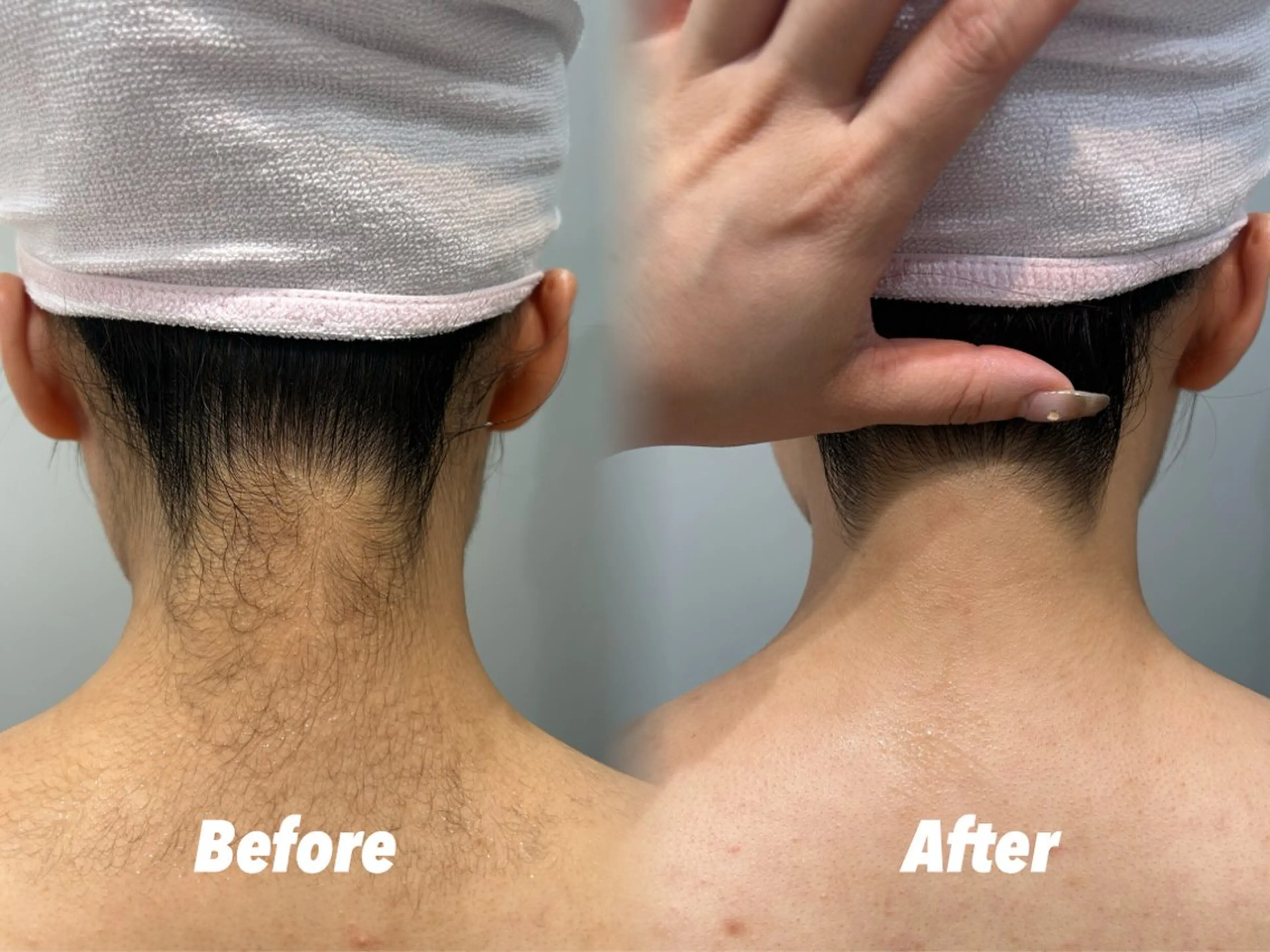 エステ リラク 🫧美しい素肌へ🫧 今成柚乃のその他イメージ