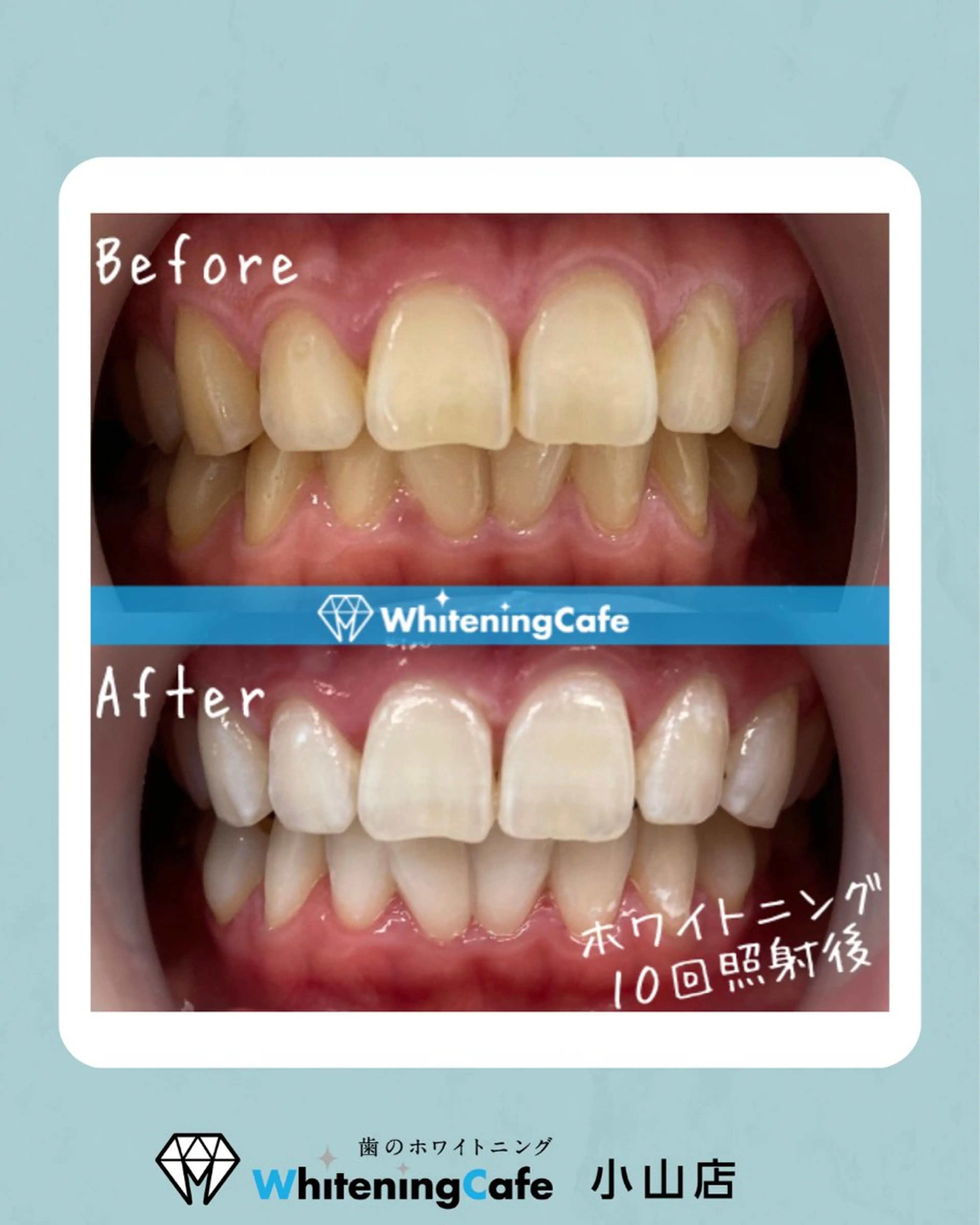 ホワイトニングカフェ 小山店のエステ・リラクイメージ