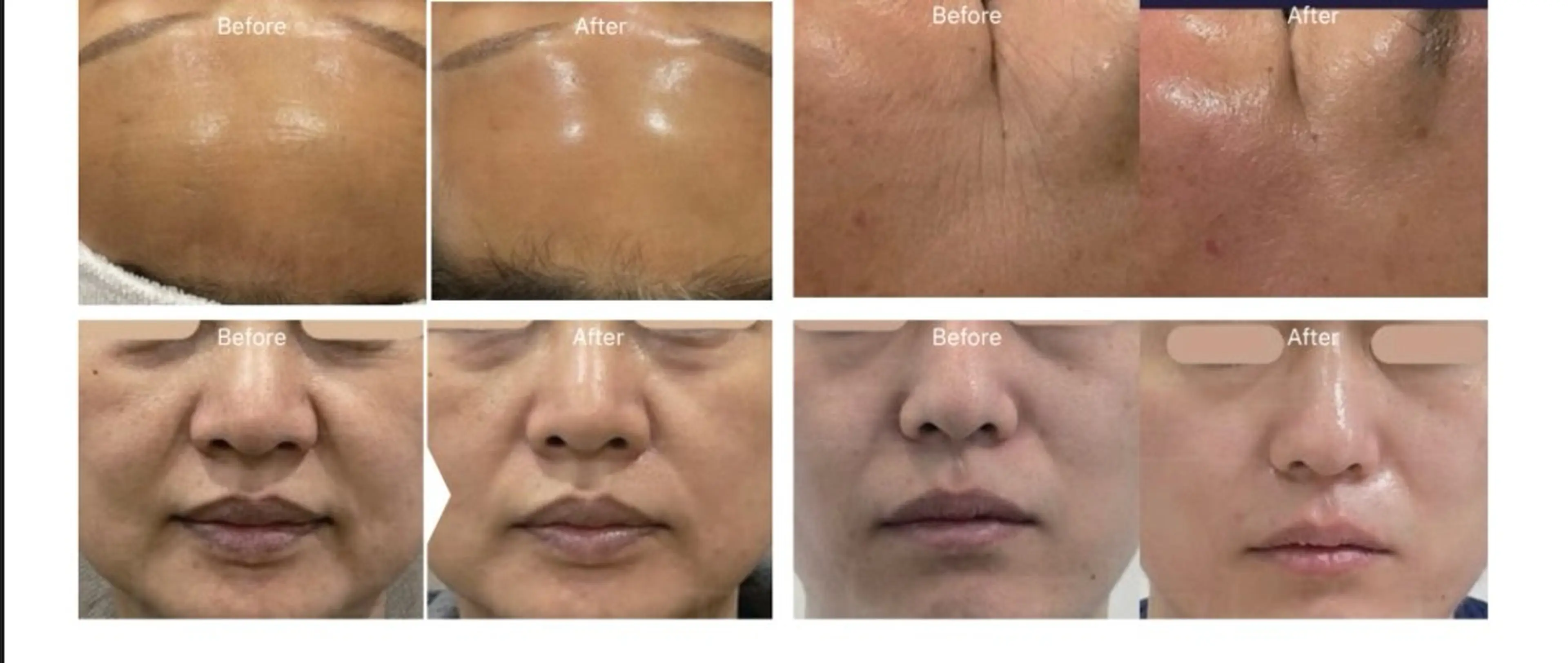 Monreve所属・美人スイッチdiet スーパージェクションのその他イメージ