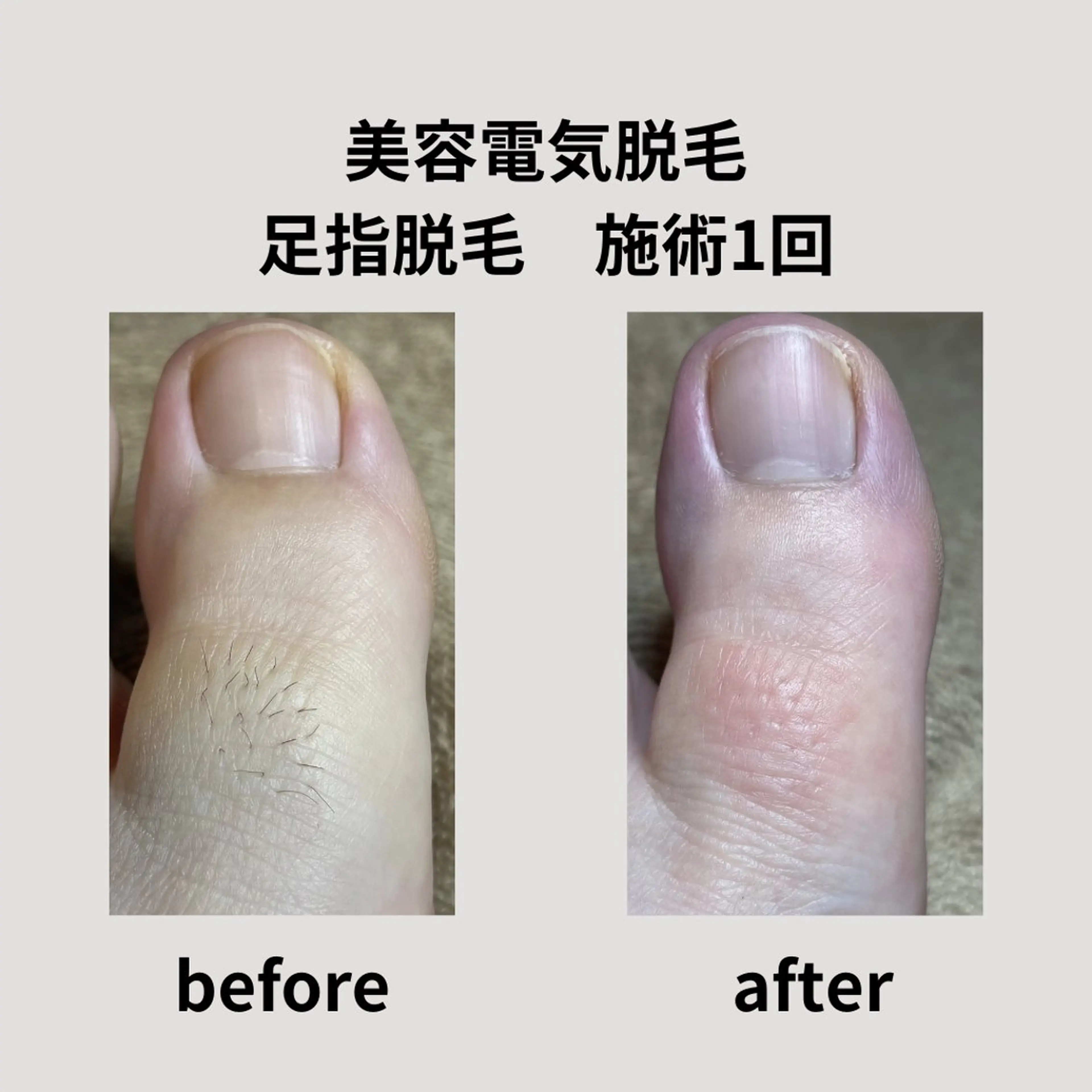 脱毛 脱毛＆フェイシャル H'euriaのエステ・リラクイメージ