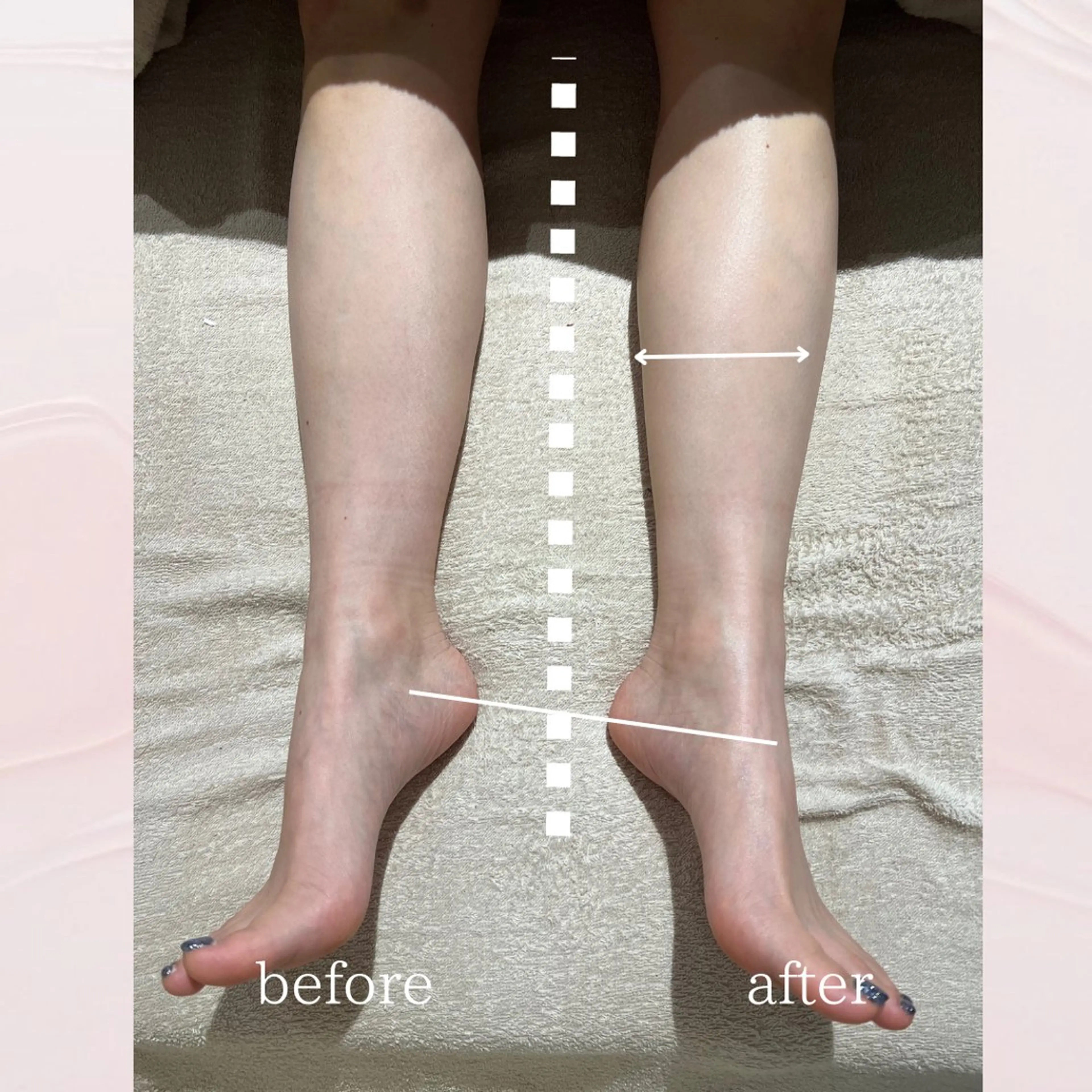 エステ リラク 【vidyto】ヴィディトゥ所属・肌管理サロン vidyto　MOEのエステ・リラクイメージ