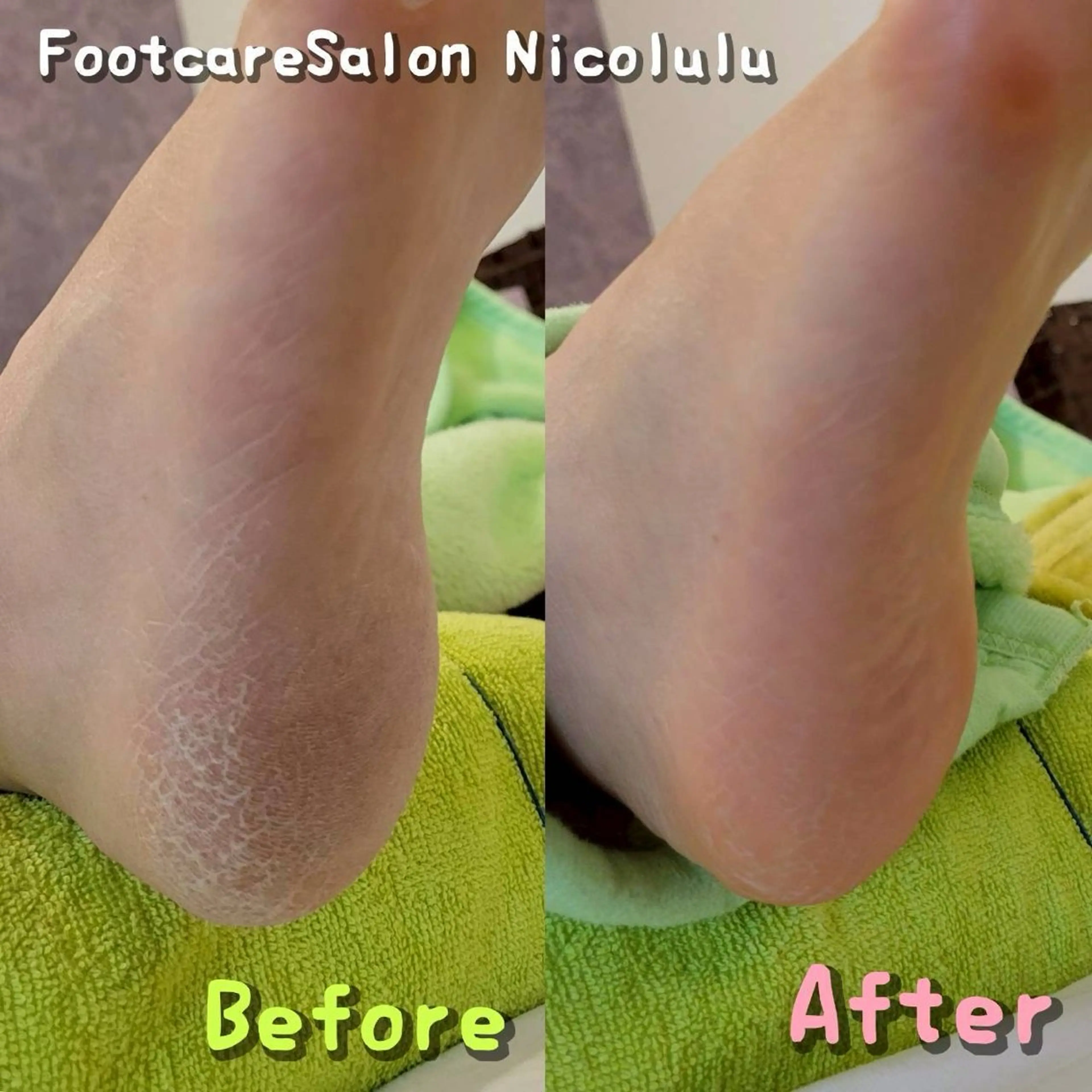 リラク 足トラブル専門 ニコルル金沢のエステ・リラクイメージ