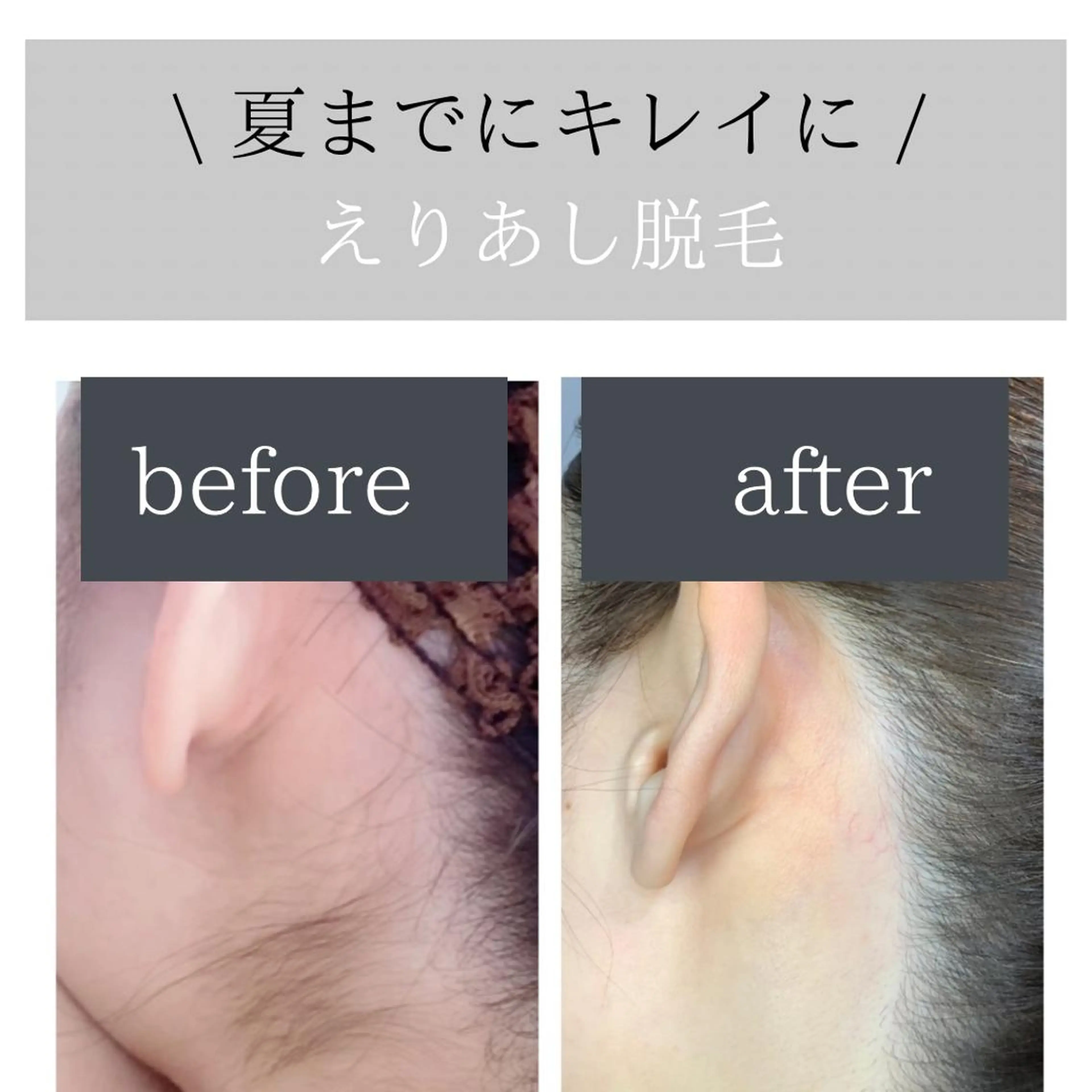 脱毛サロン Lokahiのエステ・リラクイメージ