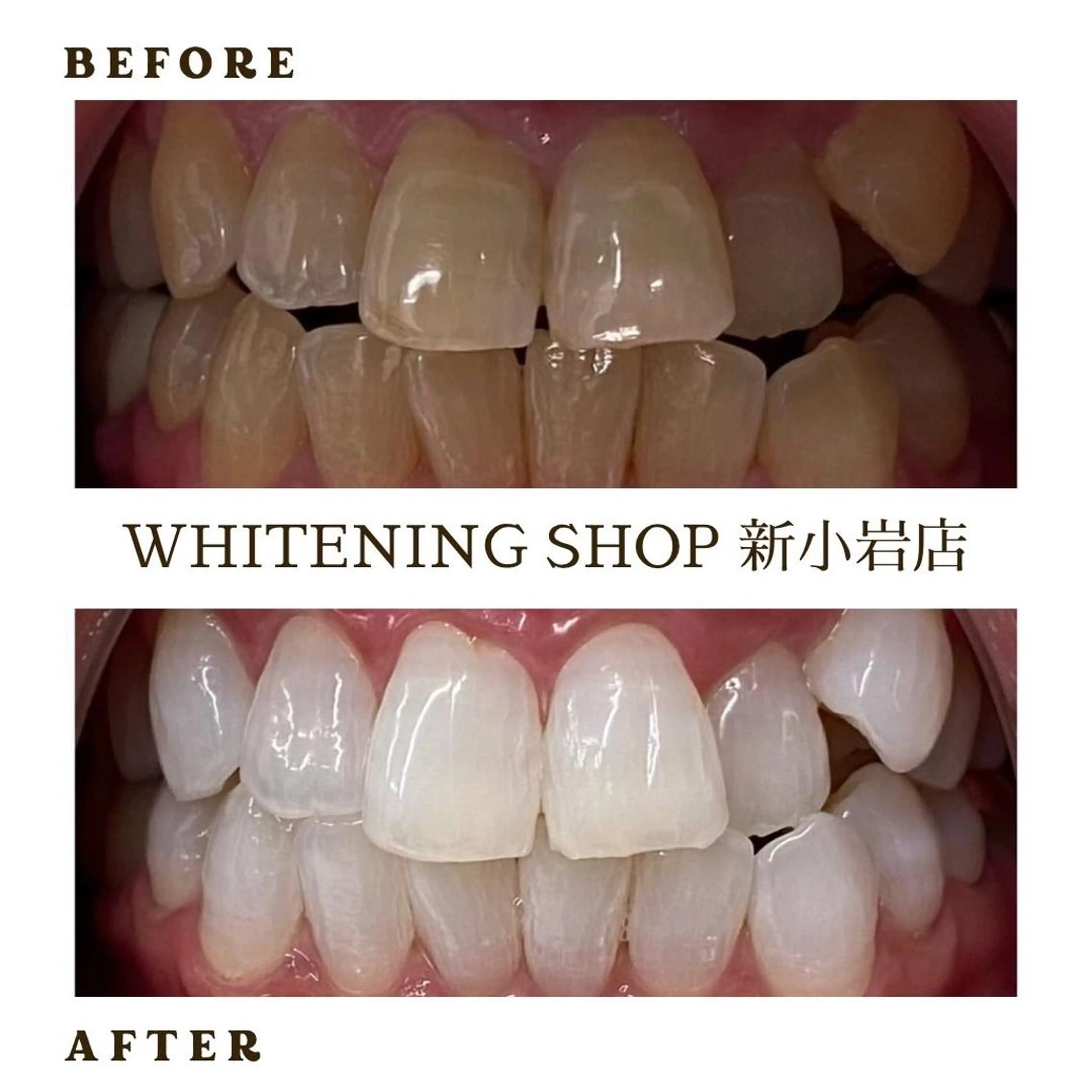 メンズ その他 ホワイトニング ショップ新小岩店のその他イメージ