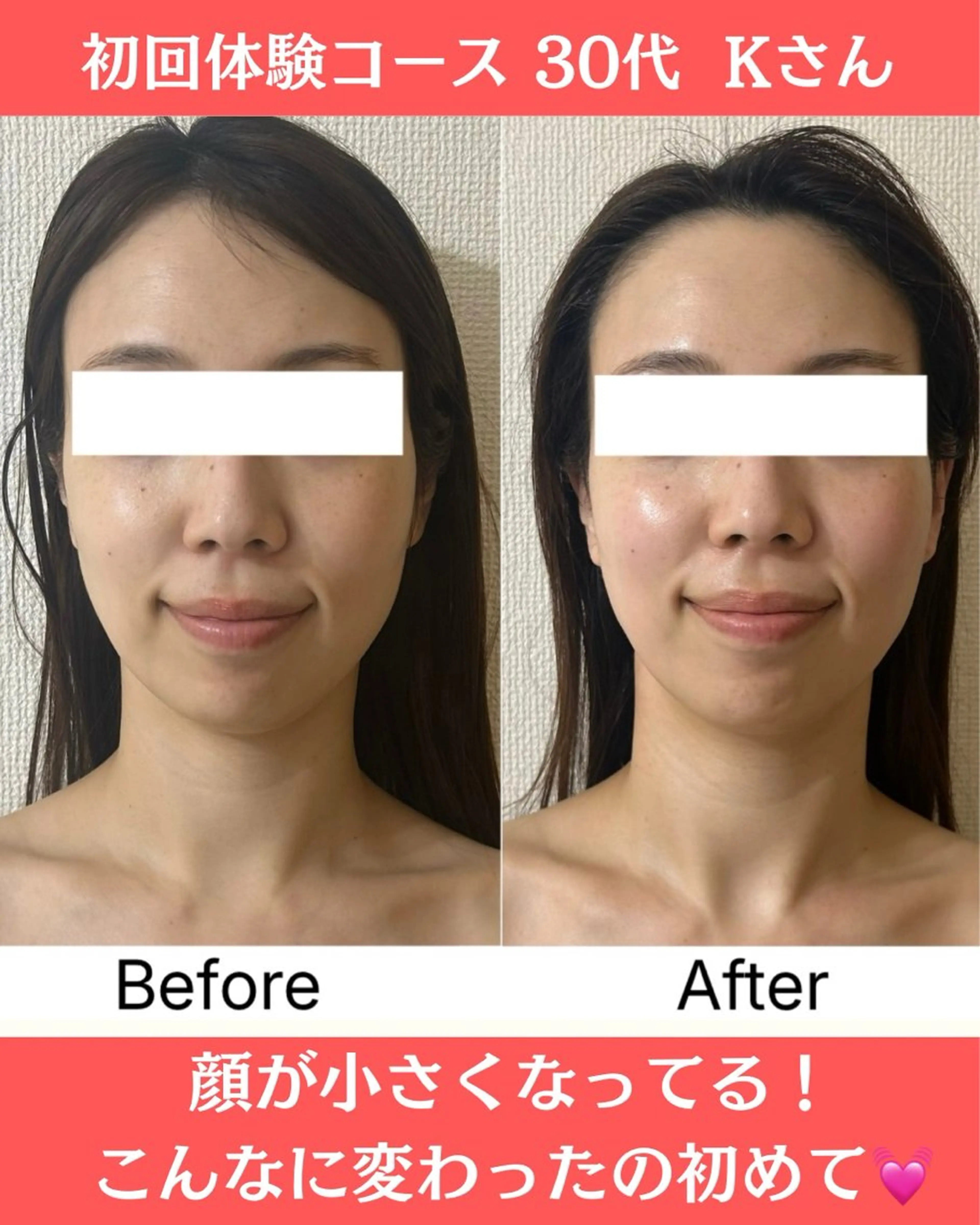 小顔サロン (ラ リュミエール)のエステ・リラクイメージ