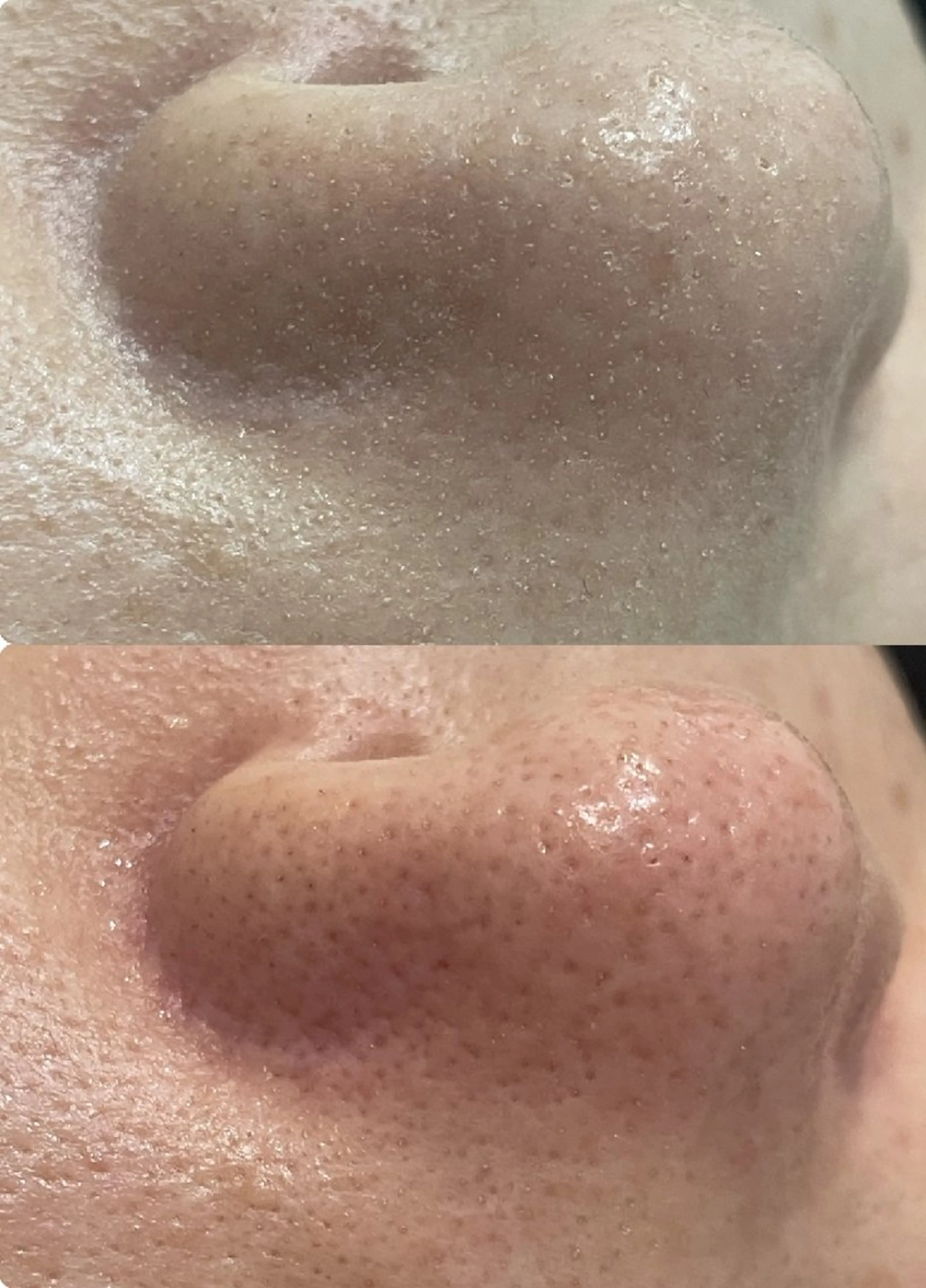 エステ sii MIUのエステ・リラクイメージ