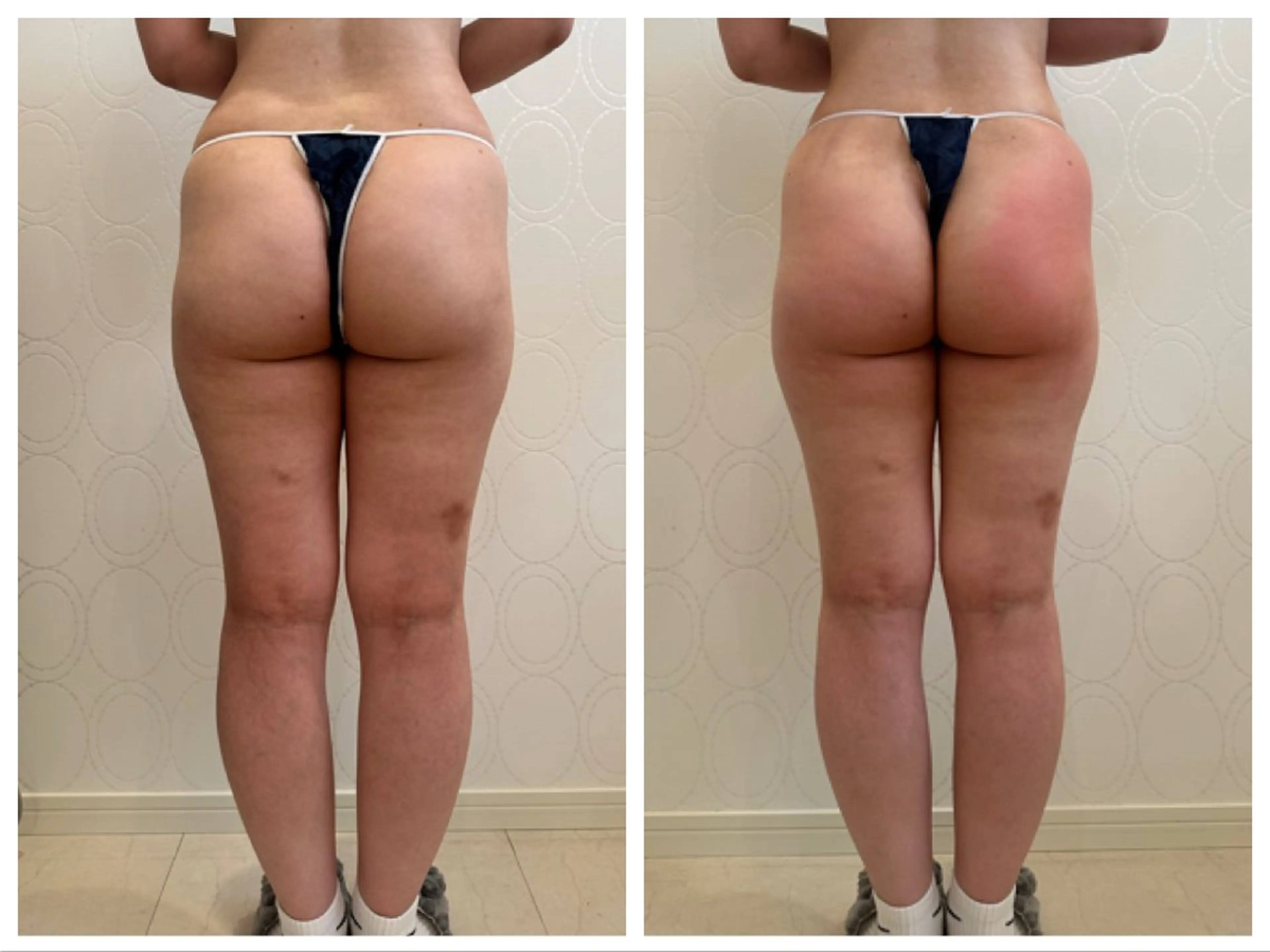 エステ トータルビューティ サロンstageのエステ・リラクイメージ